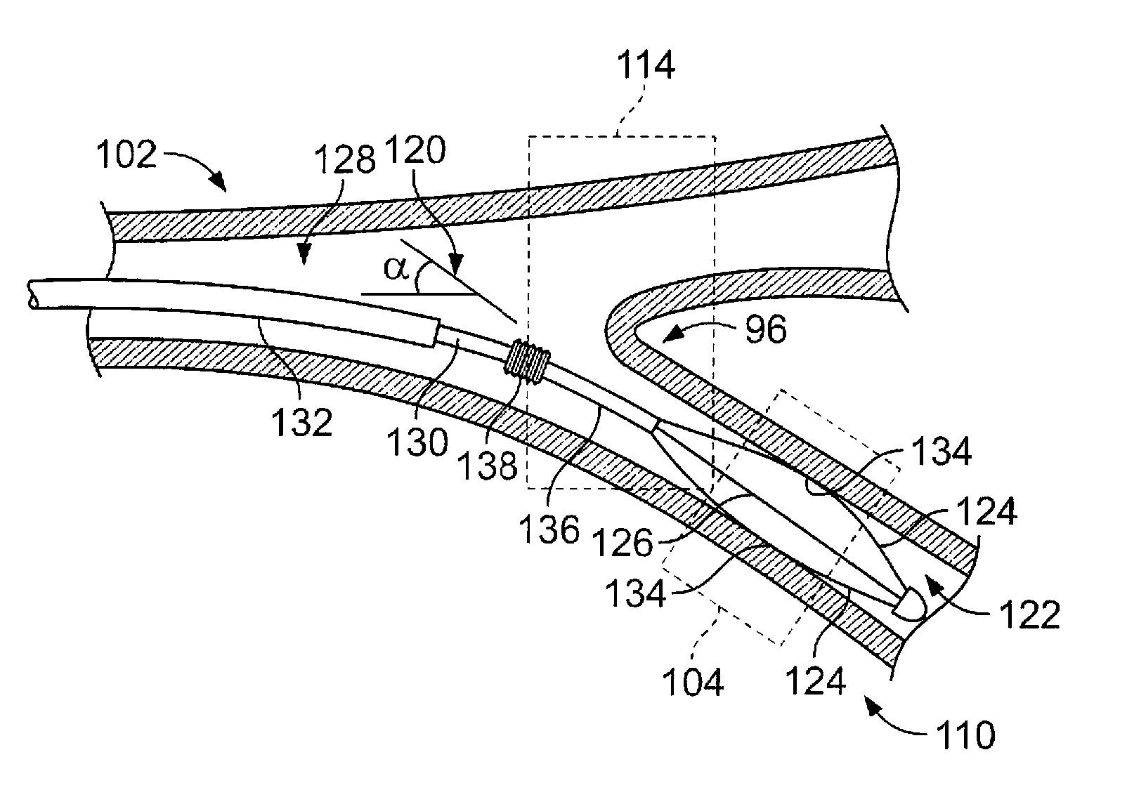 Medical device with procedure improvement features