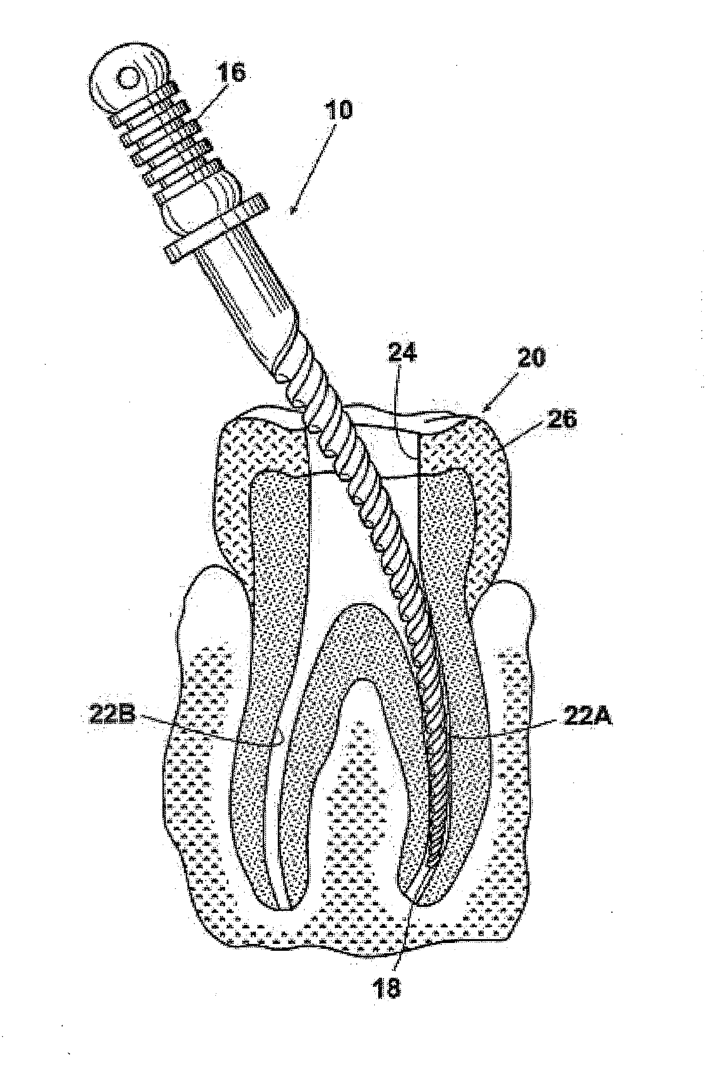 Endodontic rotary instruments made of shape memory alloys in their martensitic state and manufacturing methods