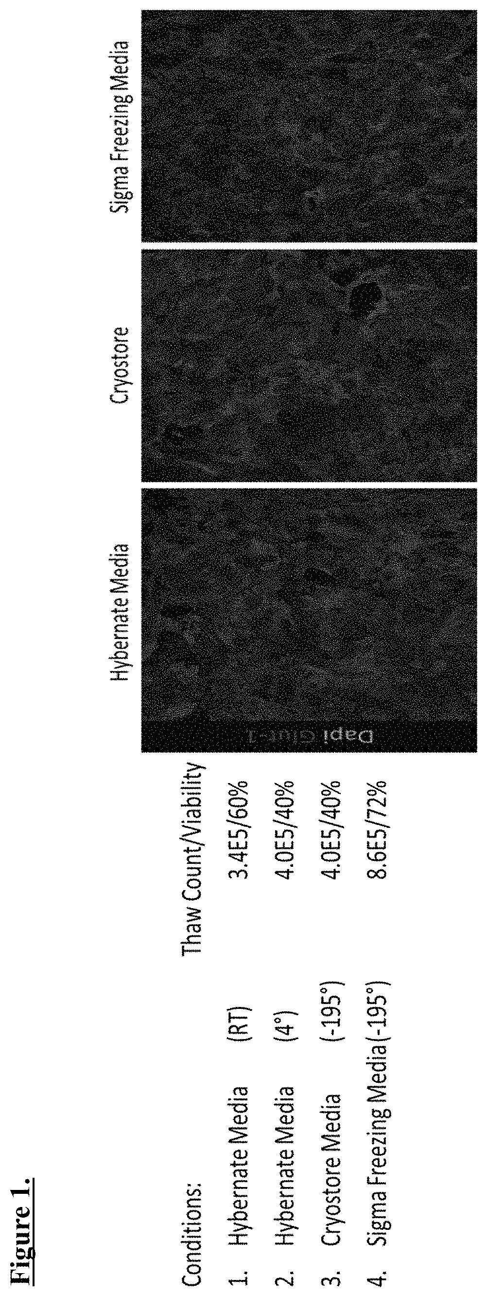 Methods and compositions for cryopreservation of endothelial cells