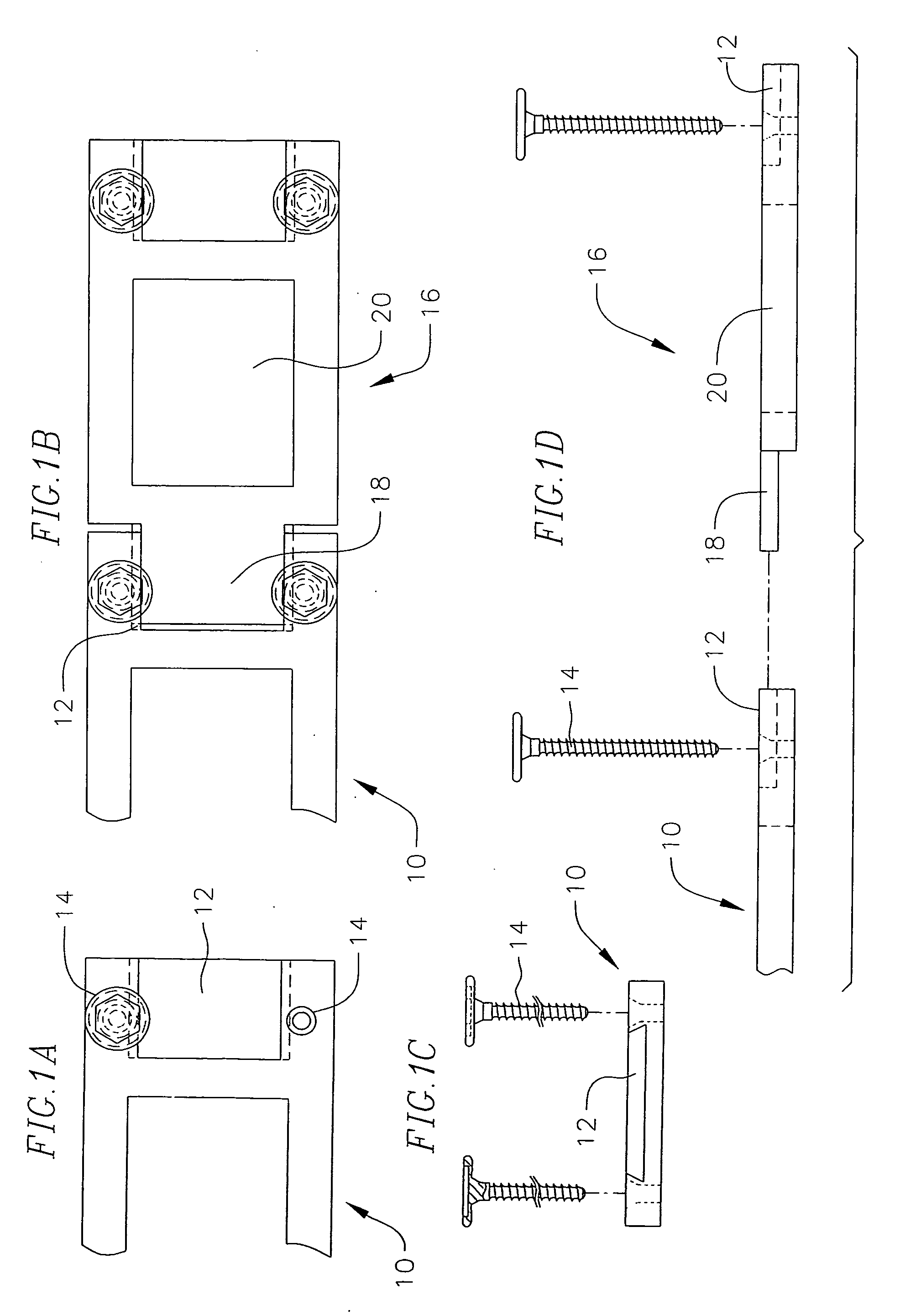 Revisable anterior cervical plating system