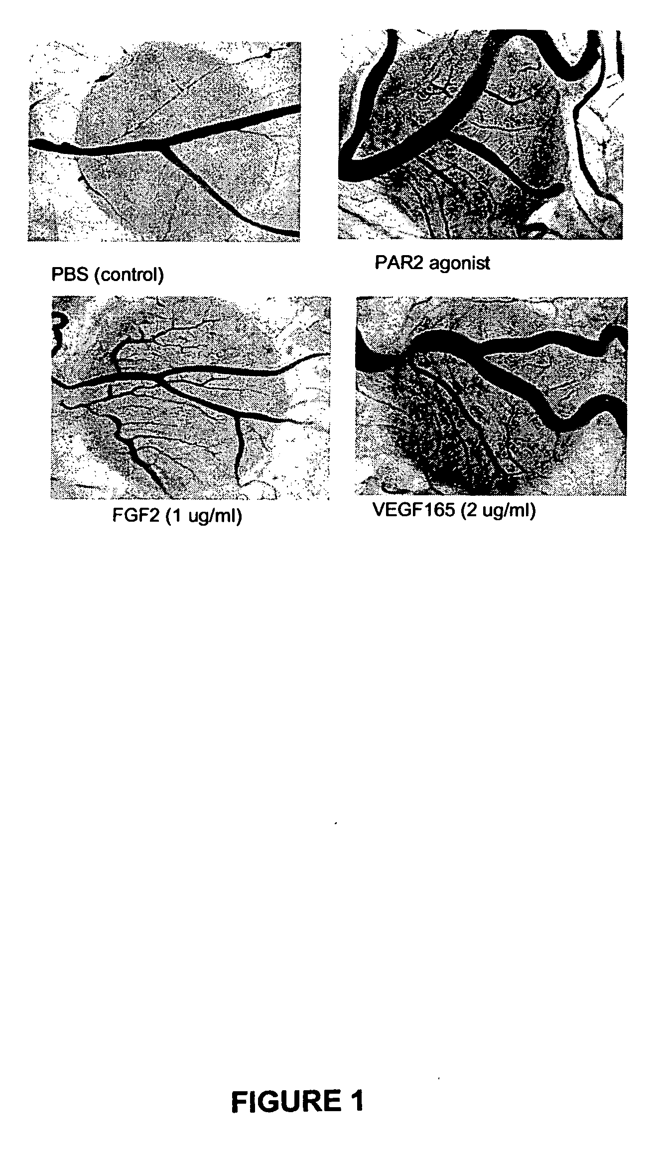 Activators and inhibitors of protease activated receptor2 (PAR2) and methods of use