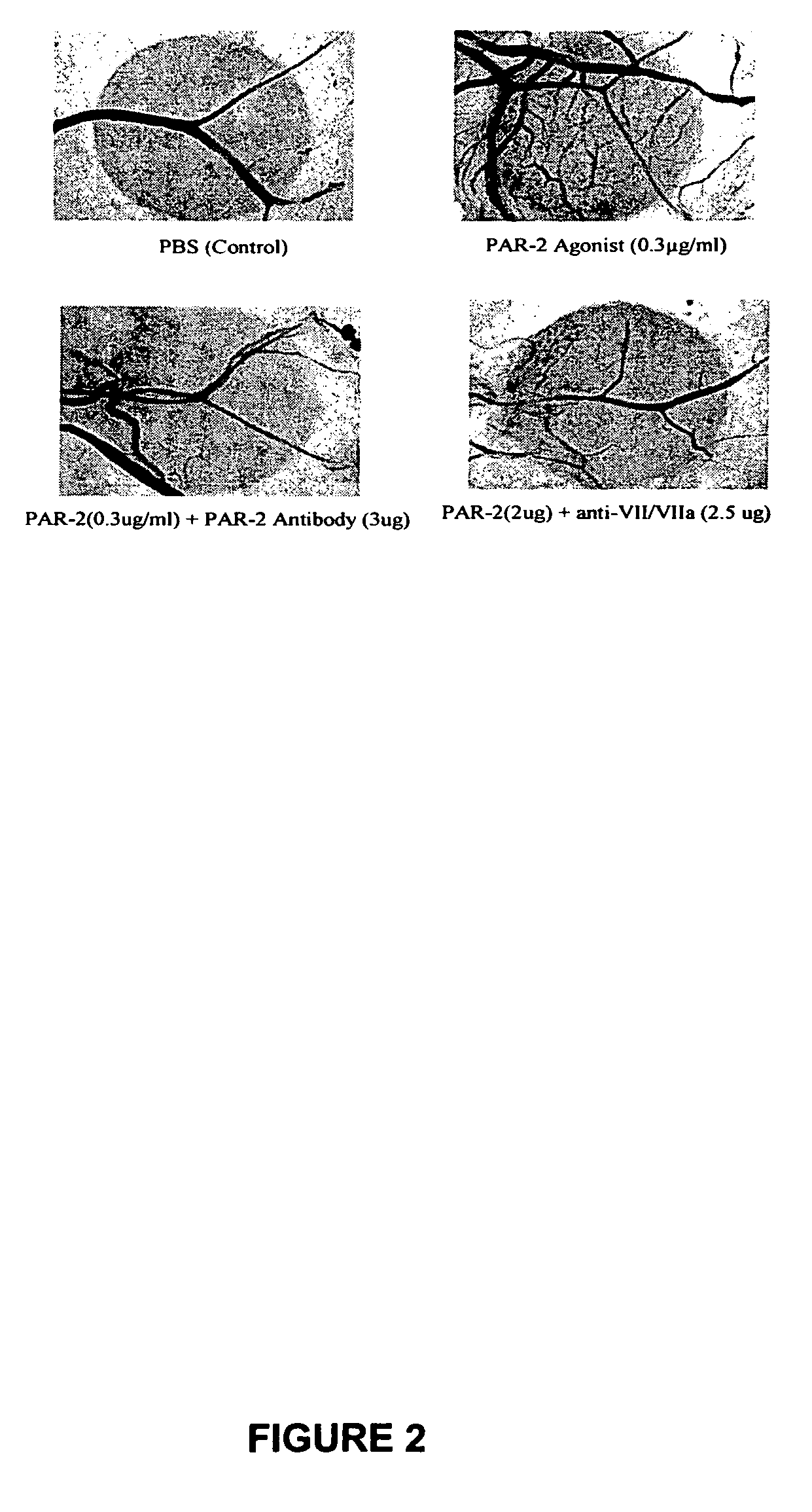 Activators and inhibitors of protease activated receptor2 (PAR2) and methods of use