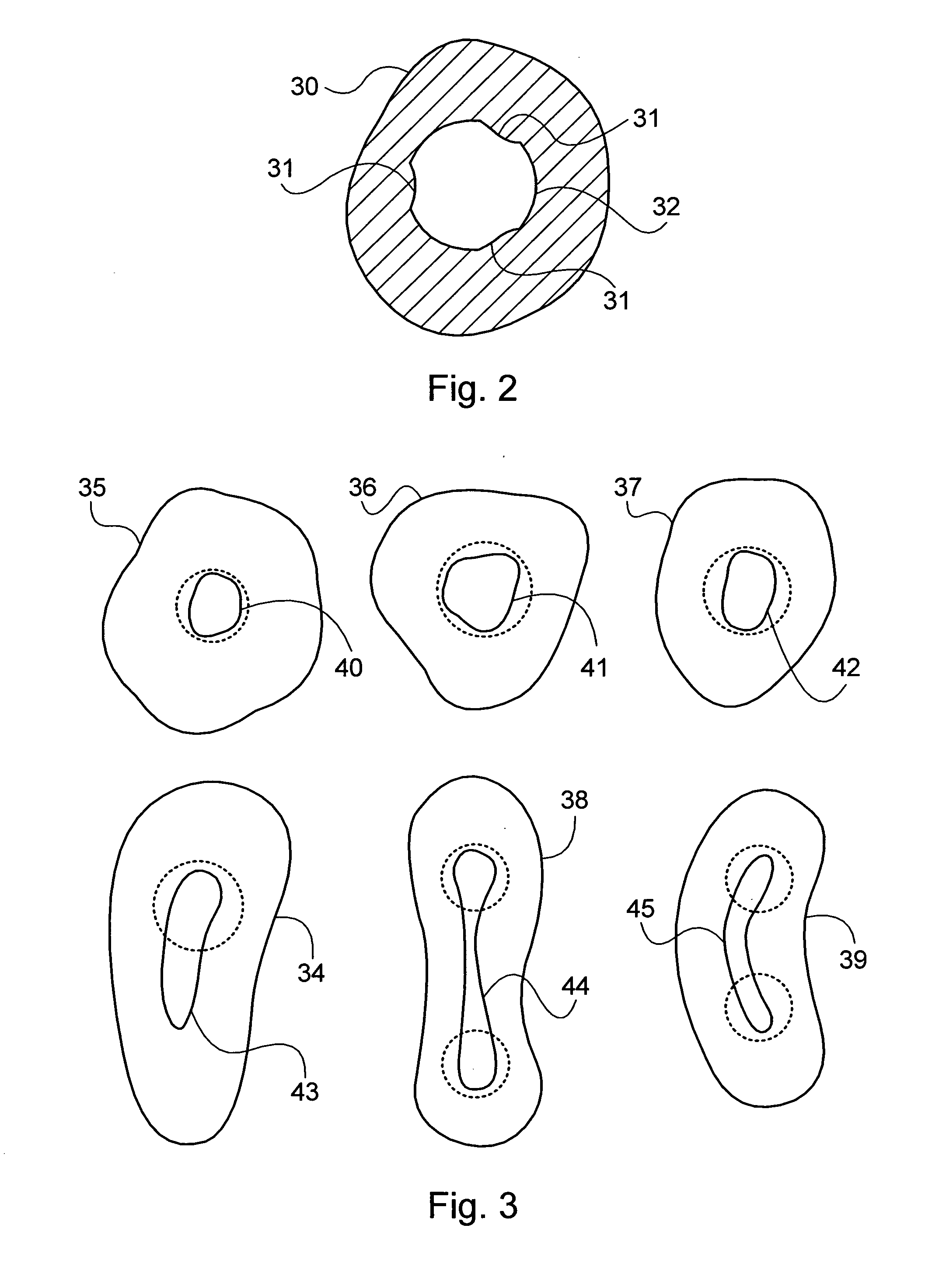 System for endodontic treatment