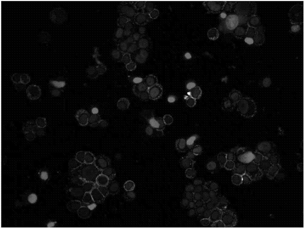 Kit for detecting prostatic cancer based on liquid biopsy