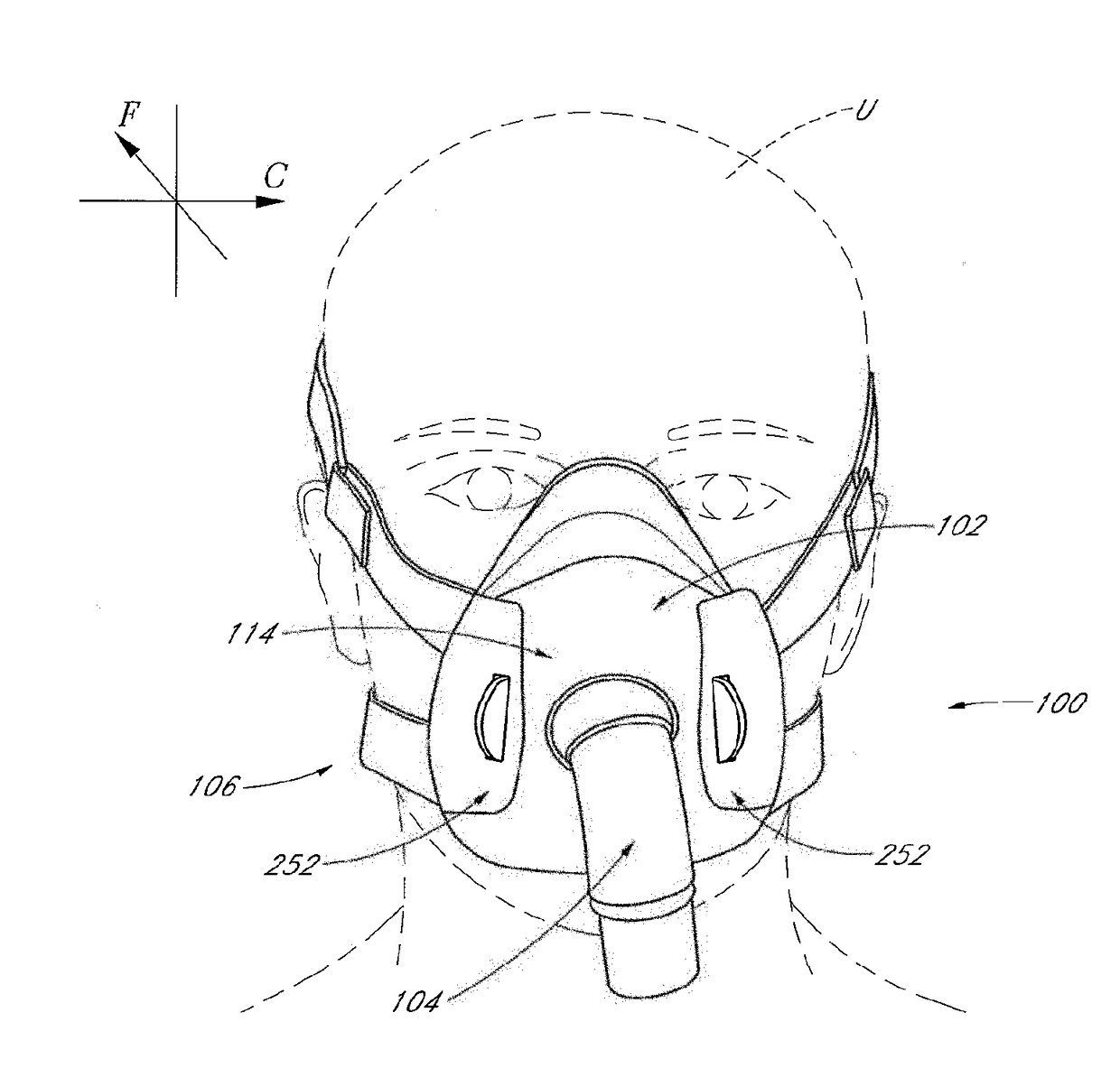 Interface comprising a rolling nasal bridge portion