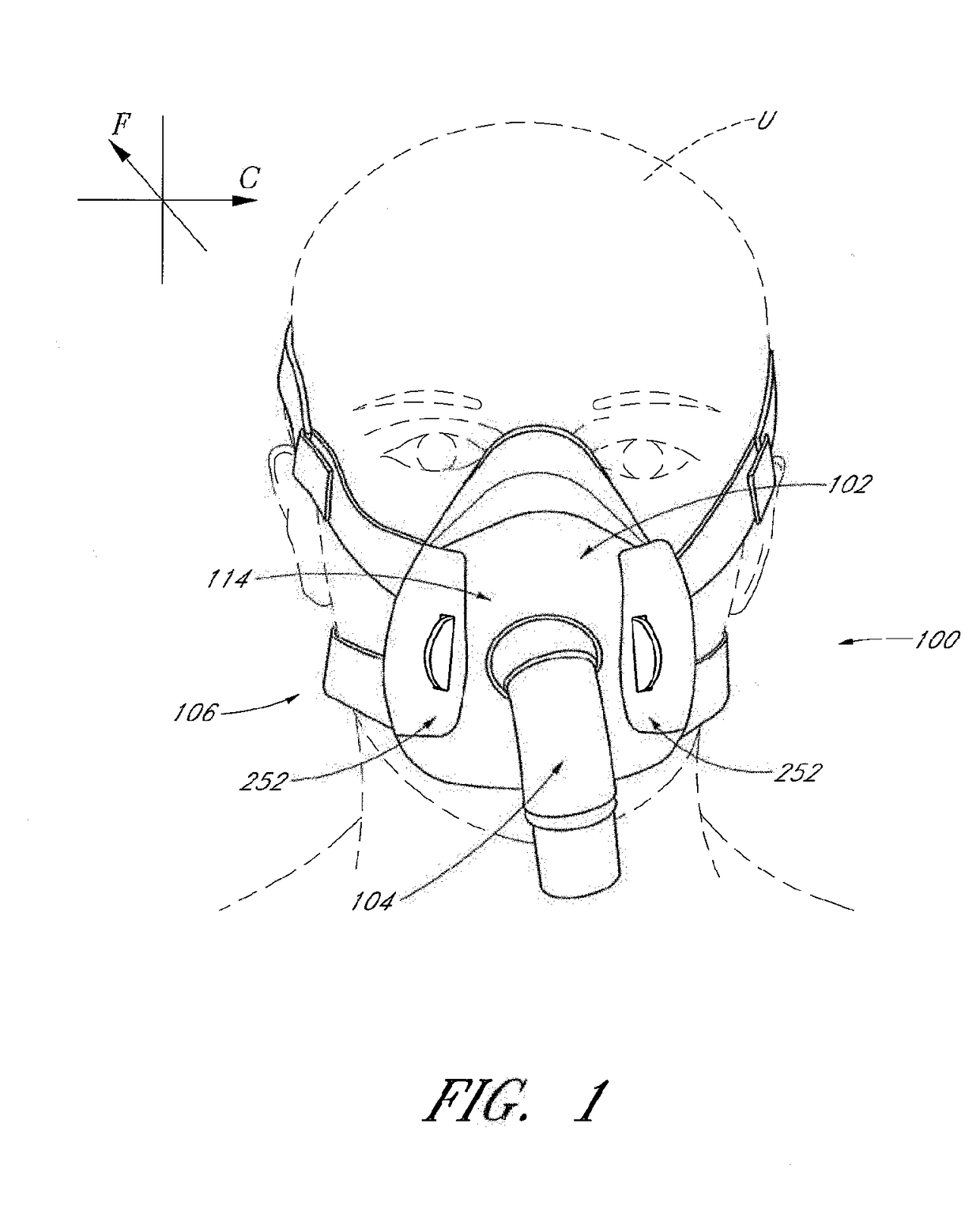 Interface comprising a rolling nasal bridge portion