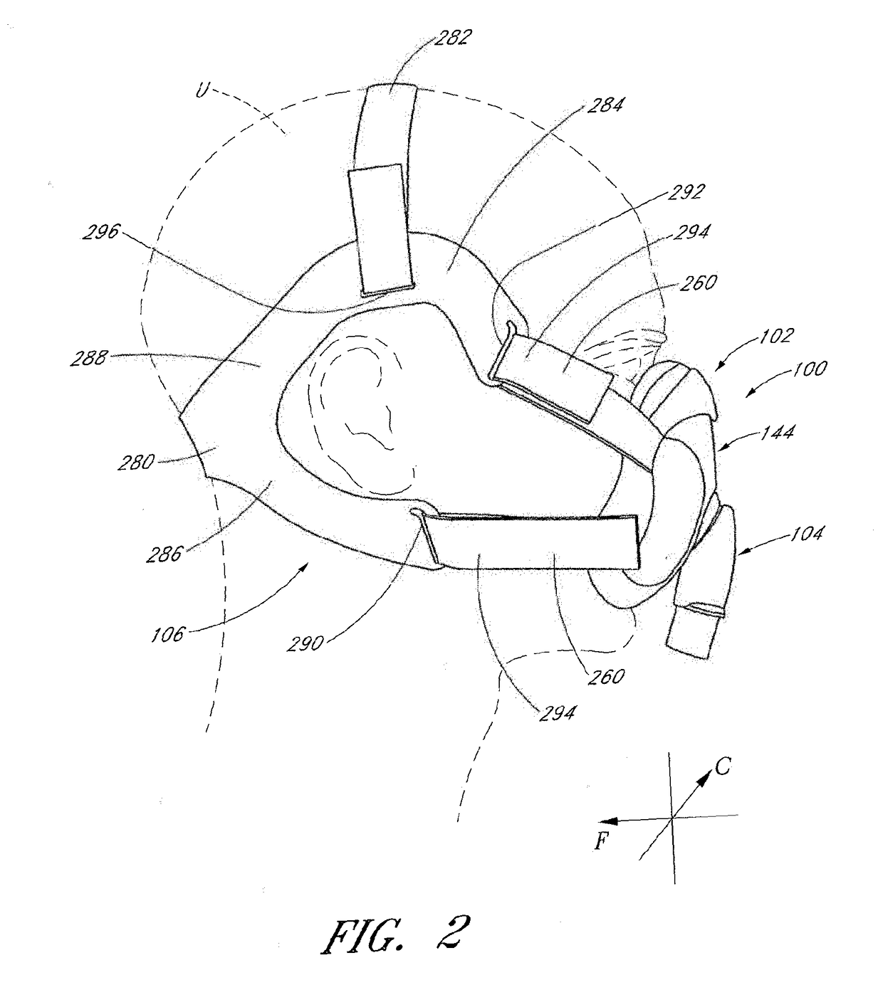 Interface comprising a rolling nasal bridge portion