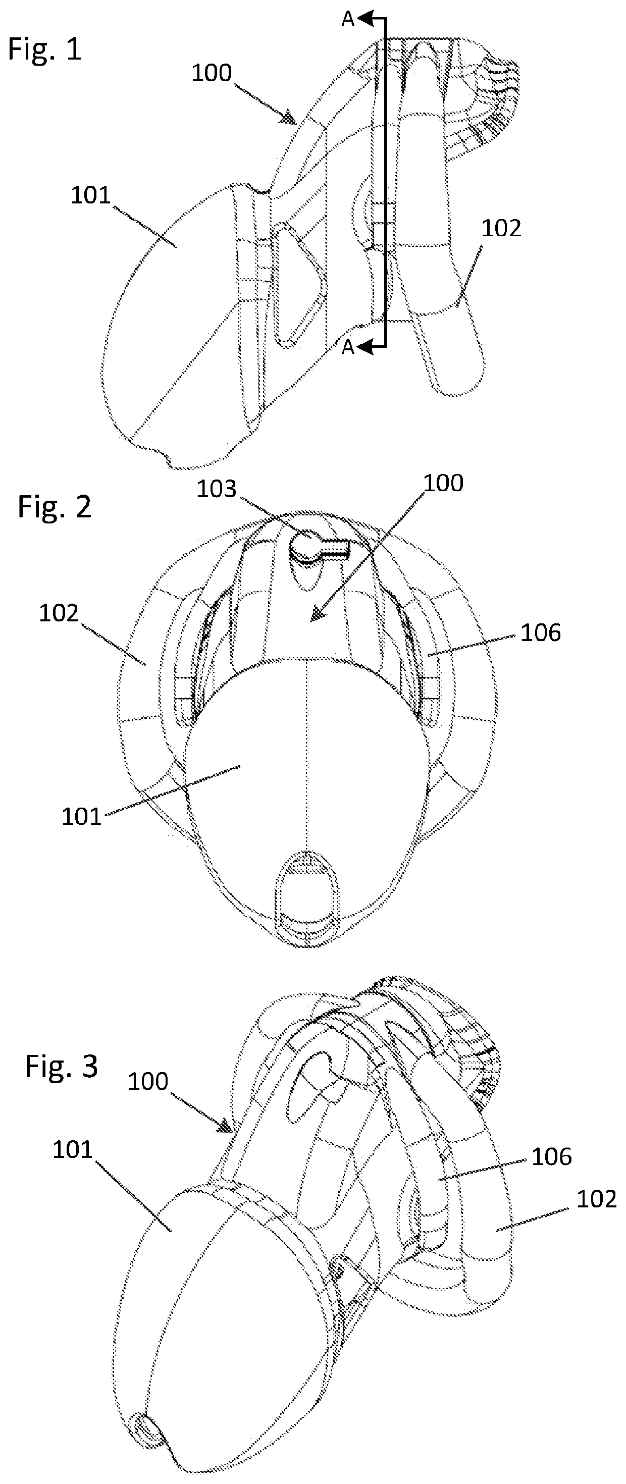 Resin-based male chastity device utilizing Anti-pullouts and multiple overmolded synthetic regions and coverings