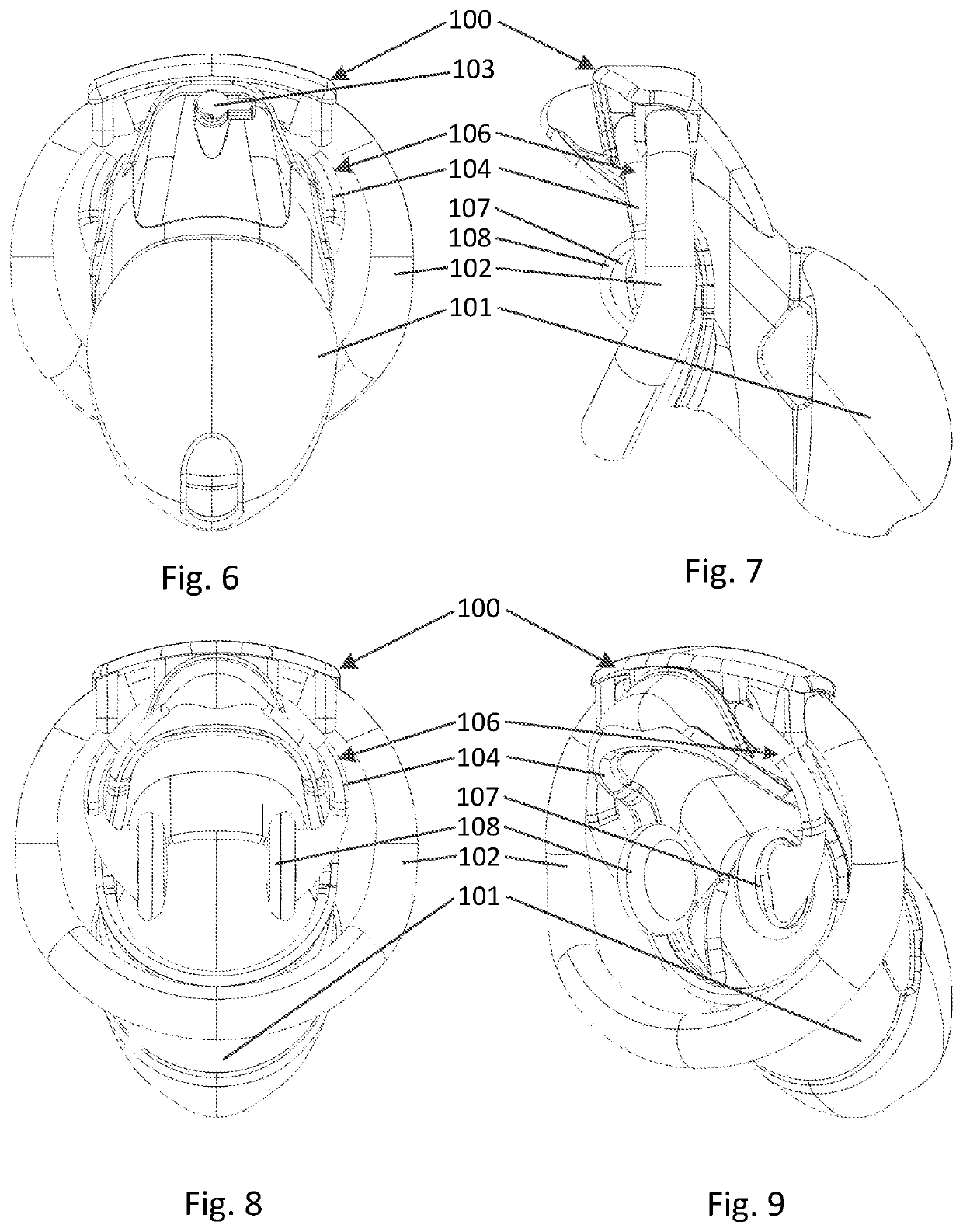 Resin-based male chastity device utilizing Anti-pullouts and multiple overmolded synthetic regions and coverings