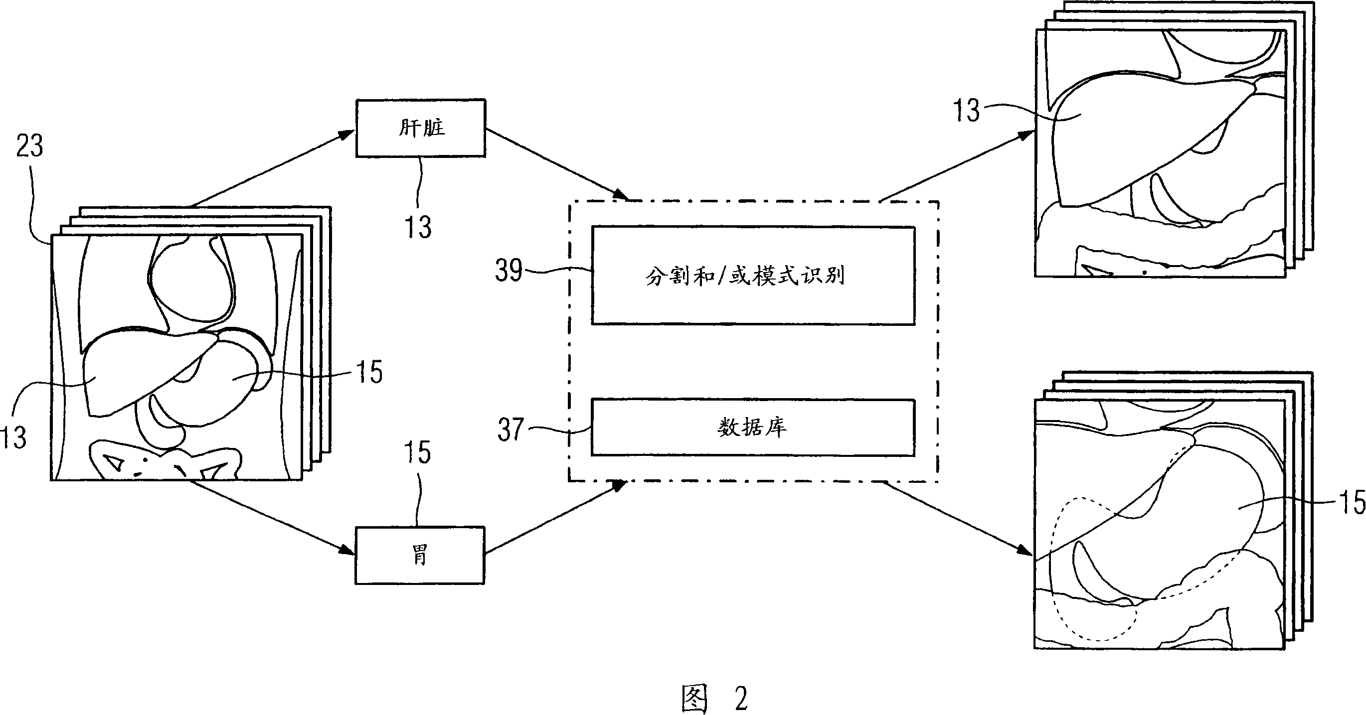 Method for generating a medical image and corresponding data processing unit and computer software