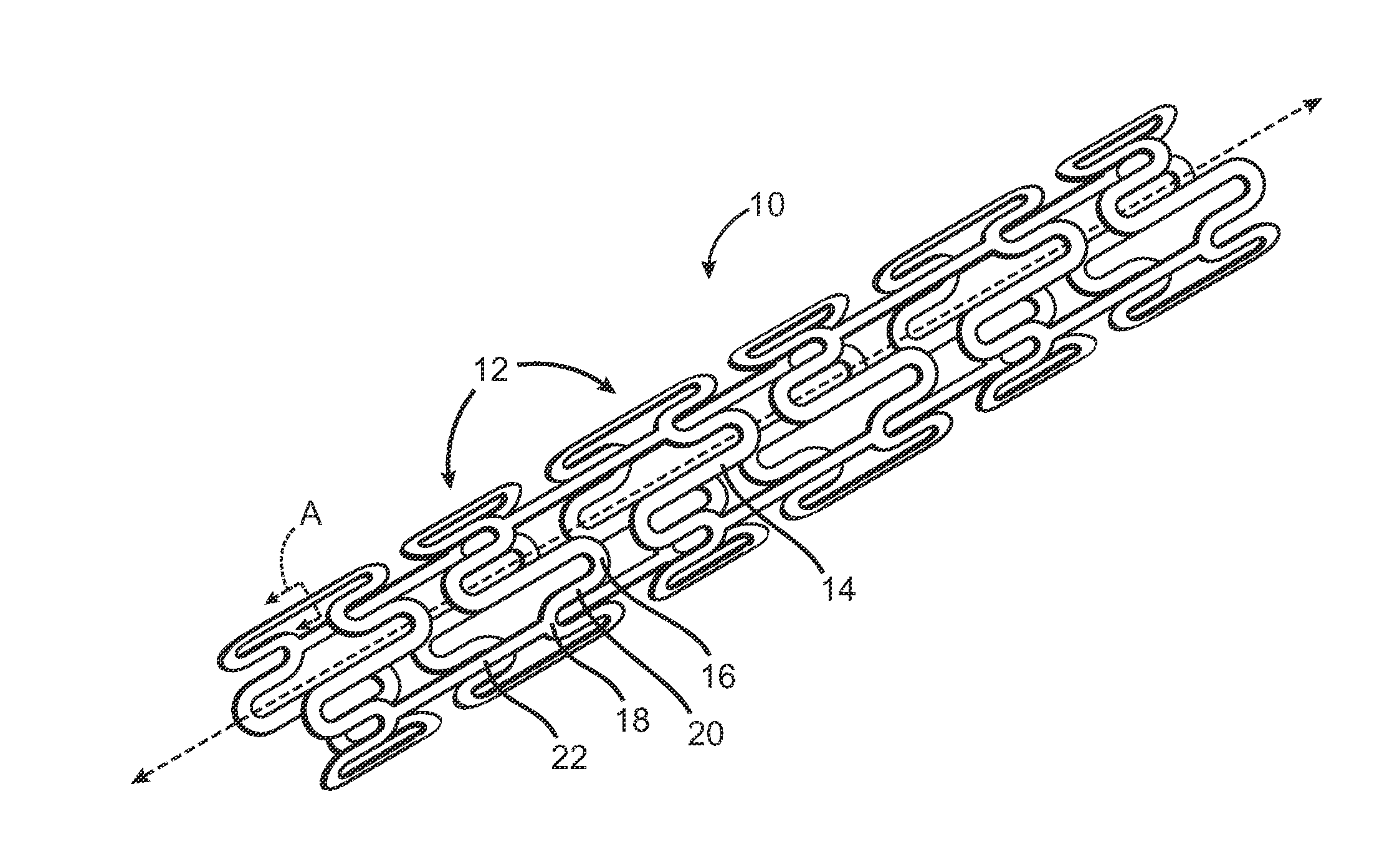 Laminated Implantable Medical Device Having a Metallic Coating