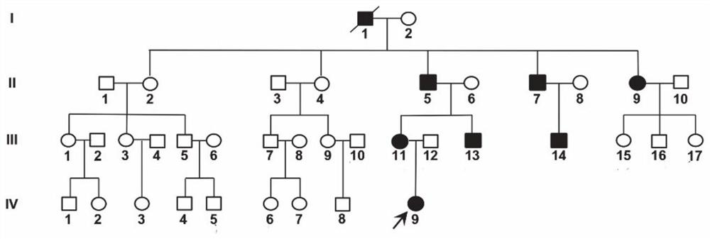 Application of Smoc2 gene and SNP marker thereof in multiple epiphyseal dysplasia