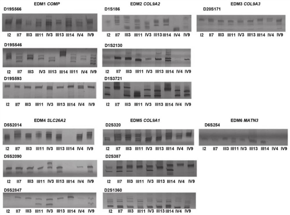 Application of Smoc2 gene and SNP marker thereof in multiple epiphyseal dysplasia