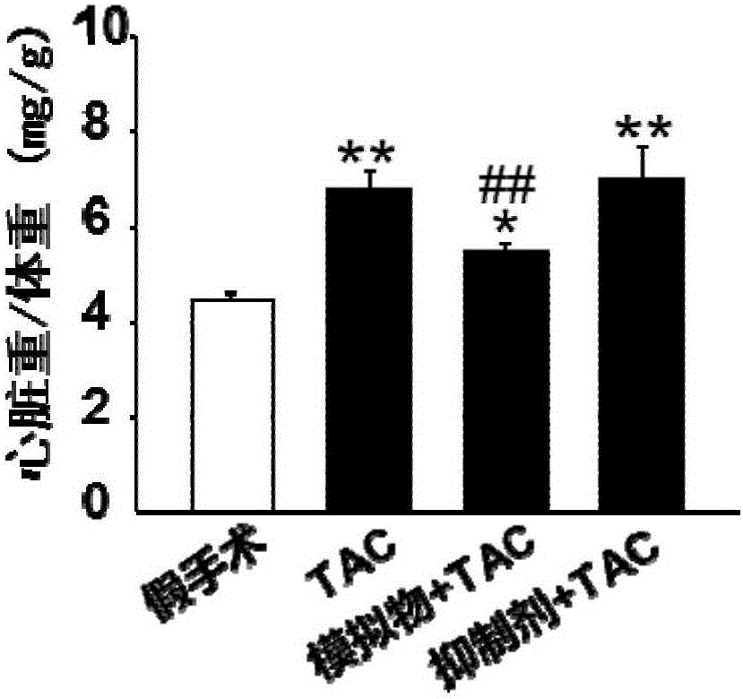 Application of miR-378 in inhibition of cardiac hypertrophy and myocardial fibrosis and diagnosis of heart failure