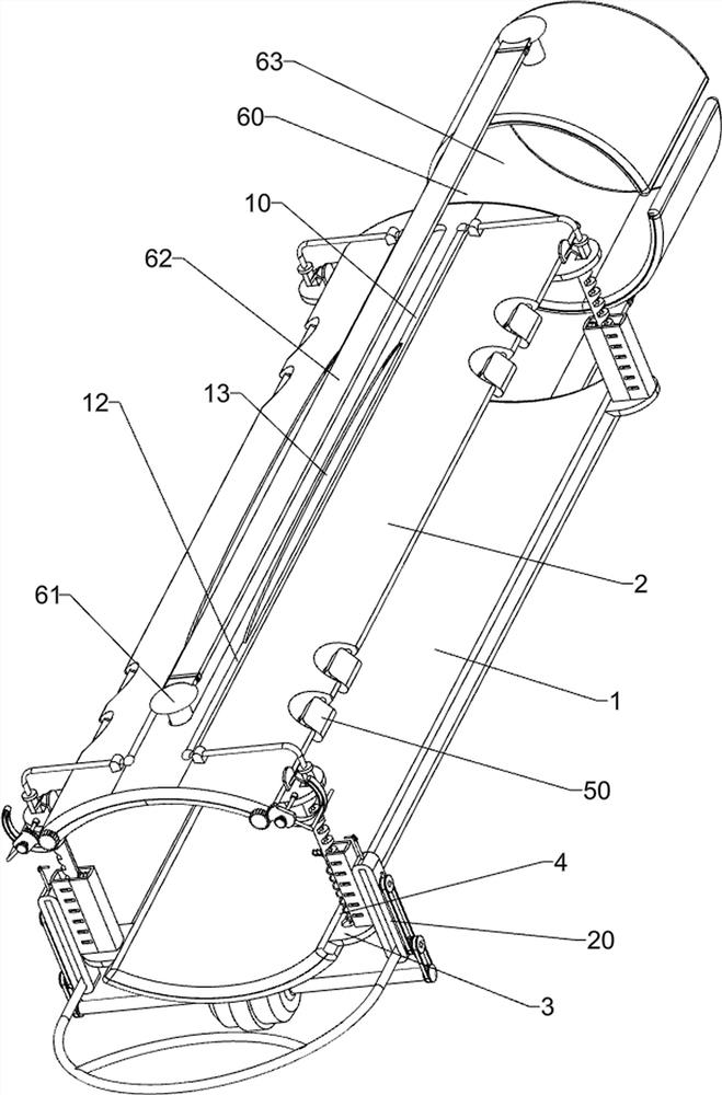 Arm fracture rapid fixing splint for orthopedics department