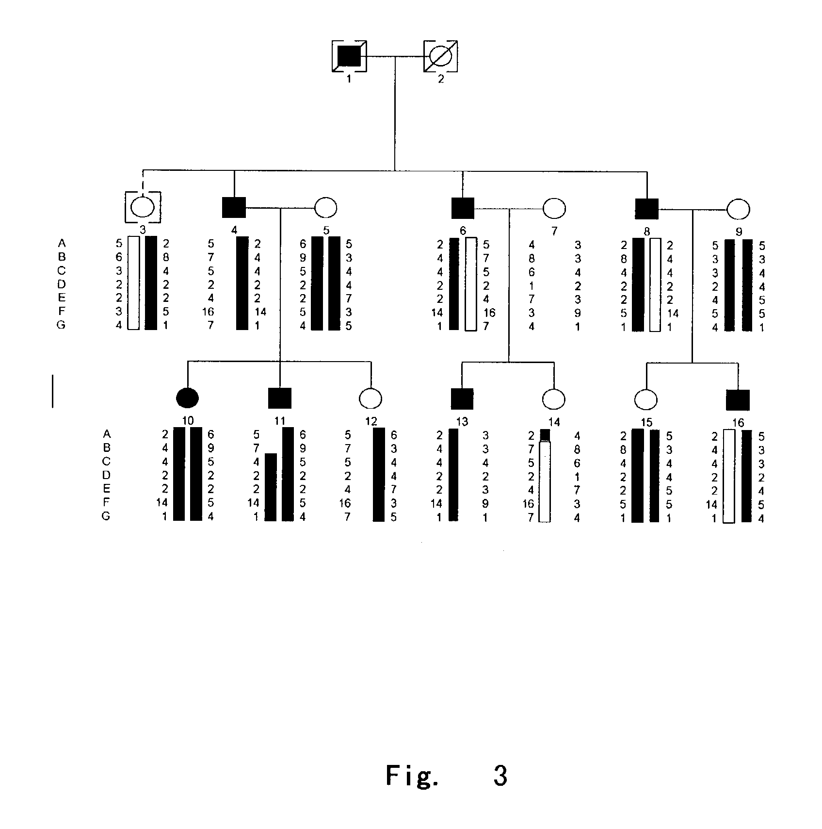 Method for diagnosing and treating dentinogenesis imperfecta type II by using dentin sialophsphoprotein (dspp)gene and its encoding product