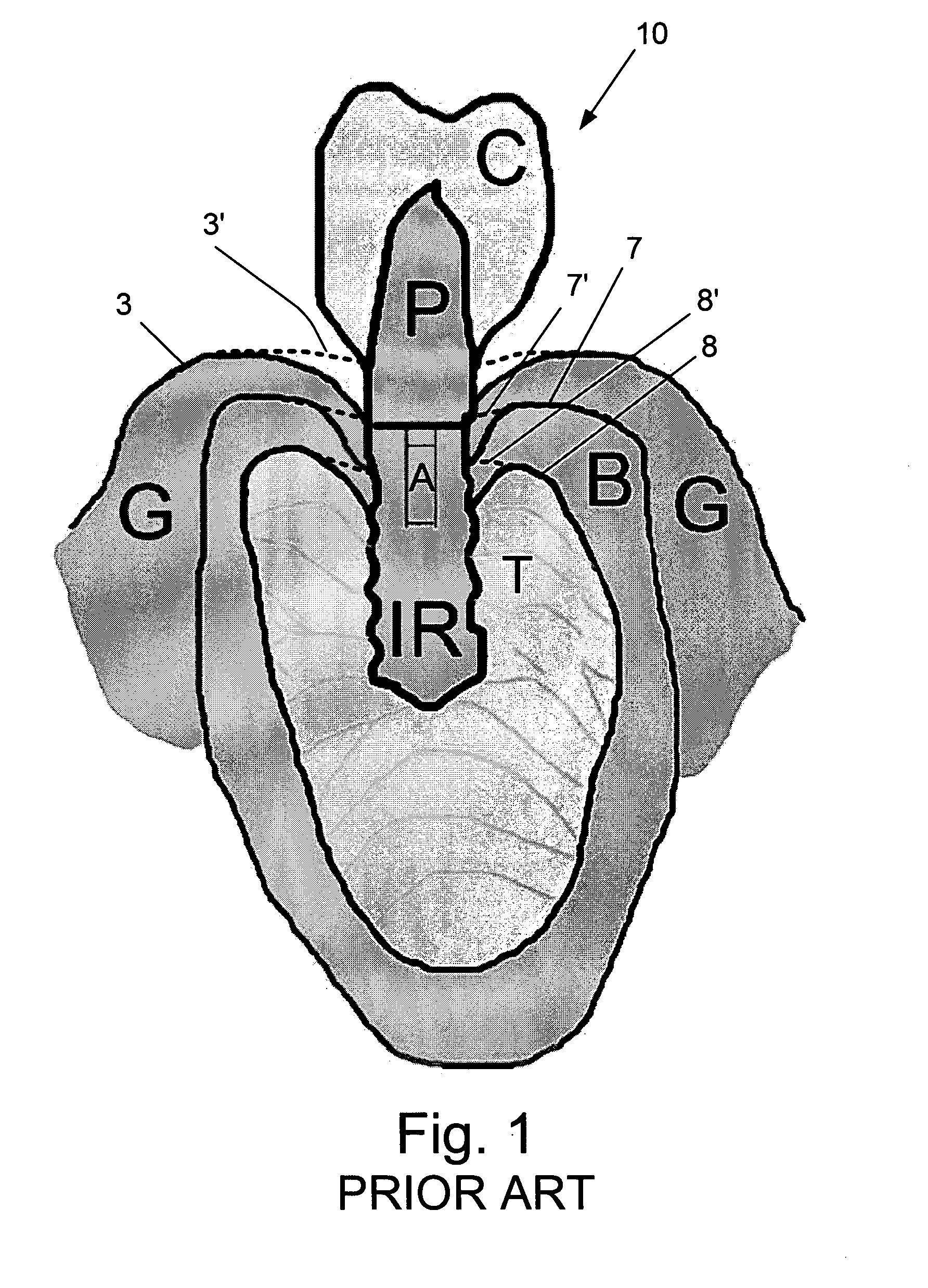 Device and Method for Gingival Attachment Associated with Endosseous Implants