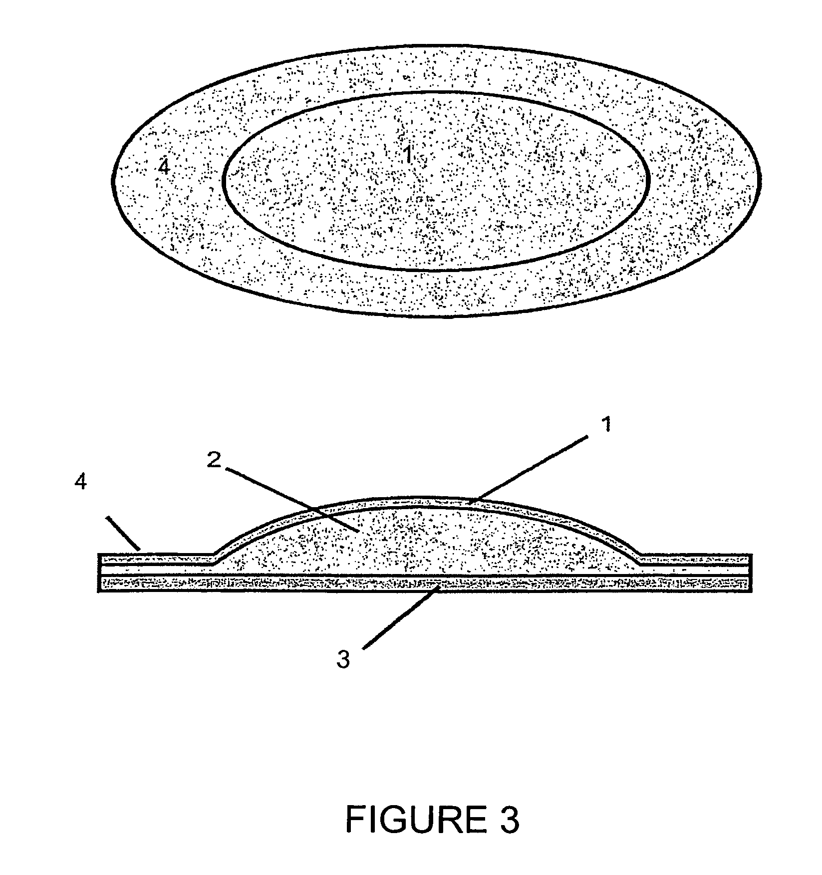 Scar-reducing plaster