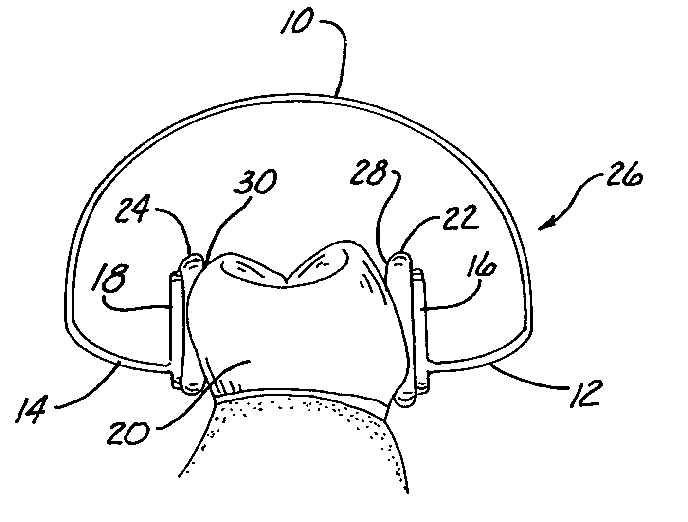 Rubber dam clamps retained by adhesion and improved frictional forces