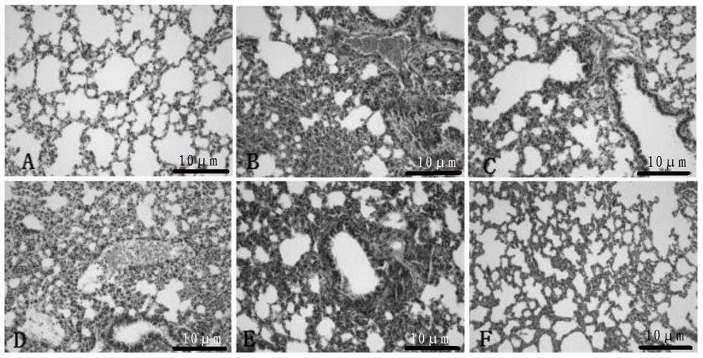 Application of turnip acidic polysaccharide BRAP-2