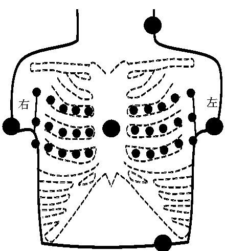 Electrocardio tomography imaging system and method