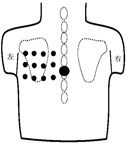 Electrocardio tomography imaging system and method