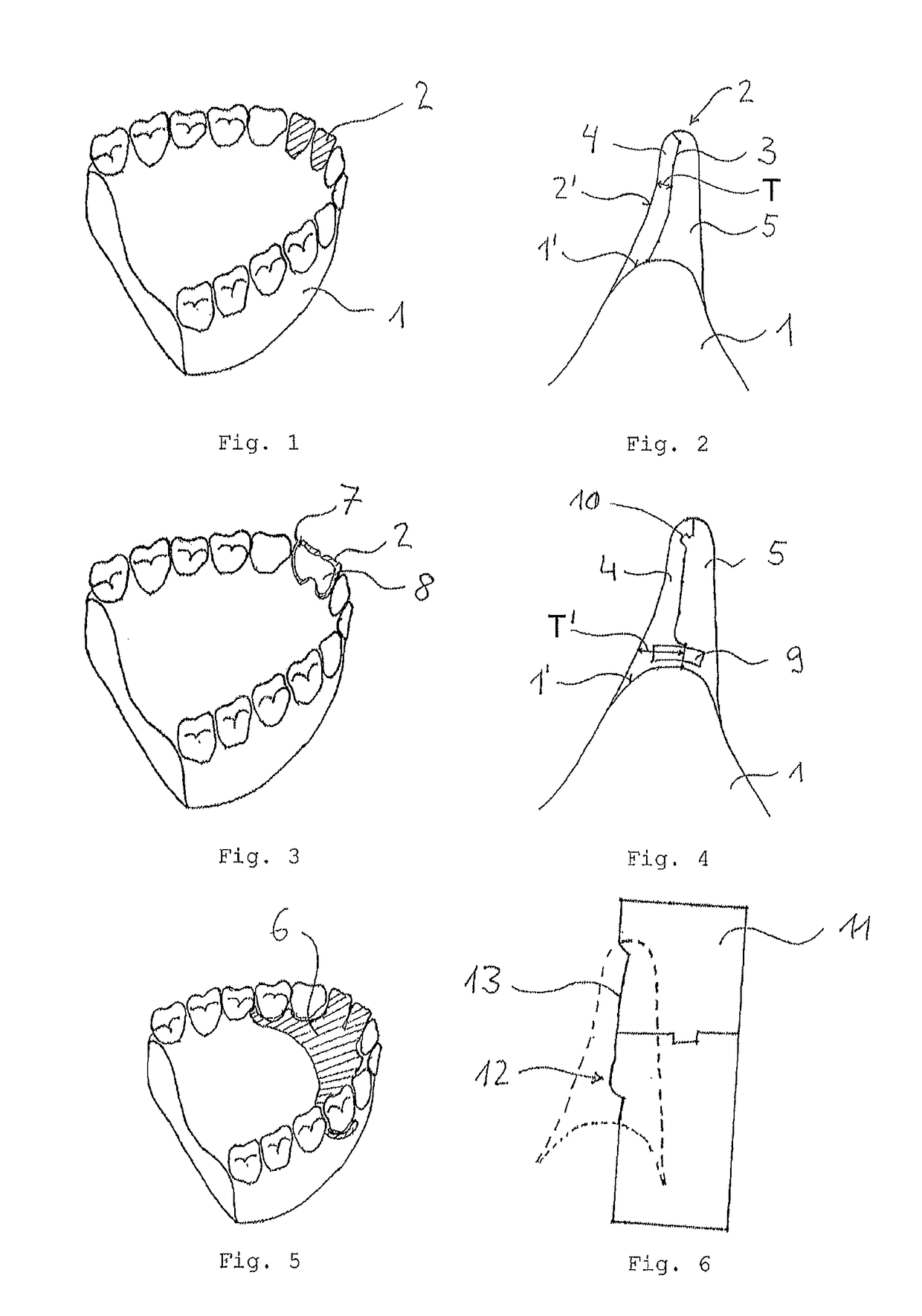 Method for generating a model of a dental replacement part