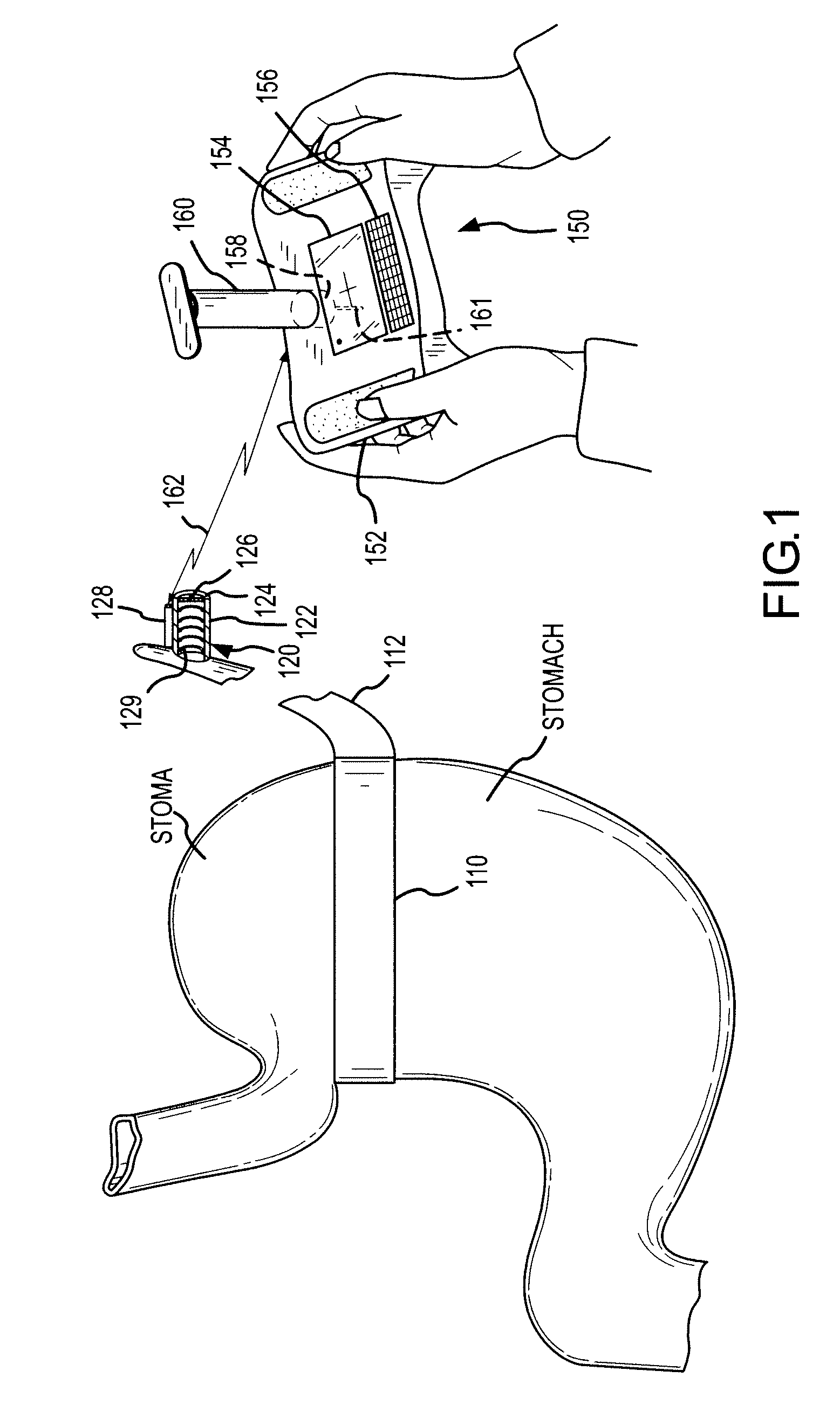 Method for locating an implanted fluid access port