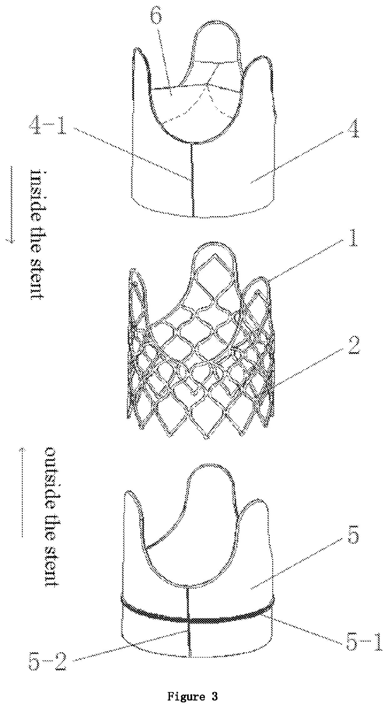 Artificial heart valve