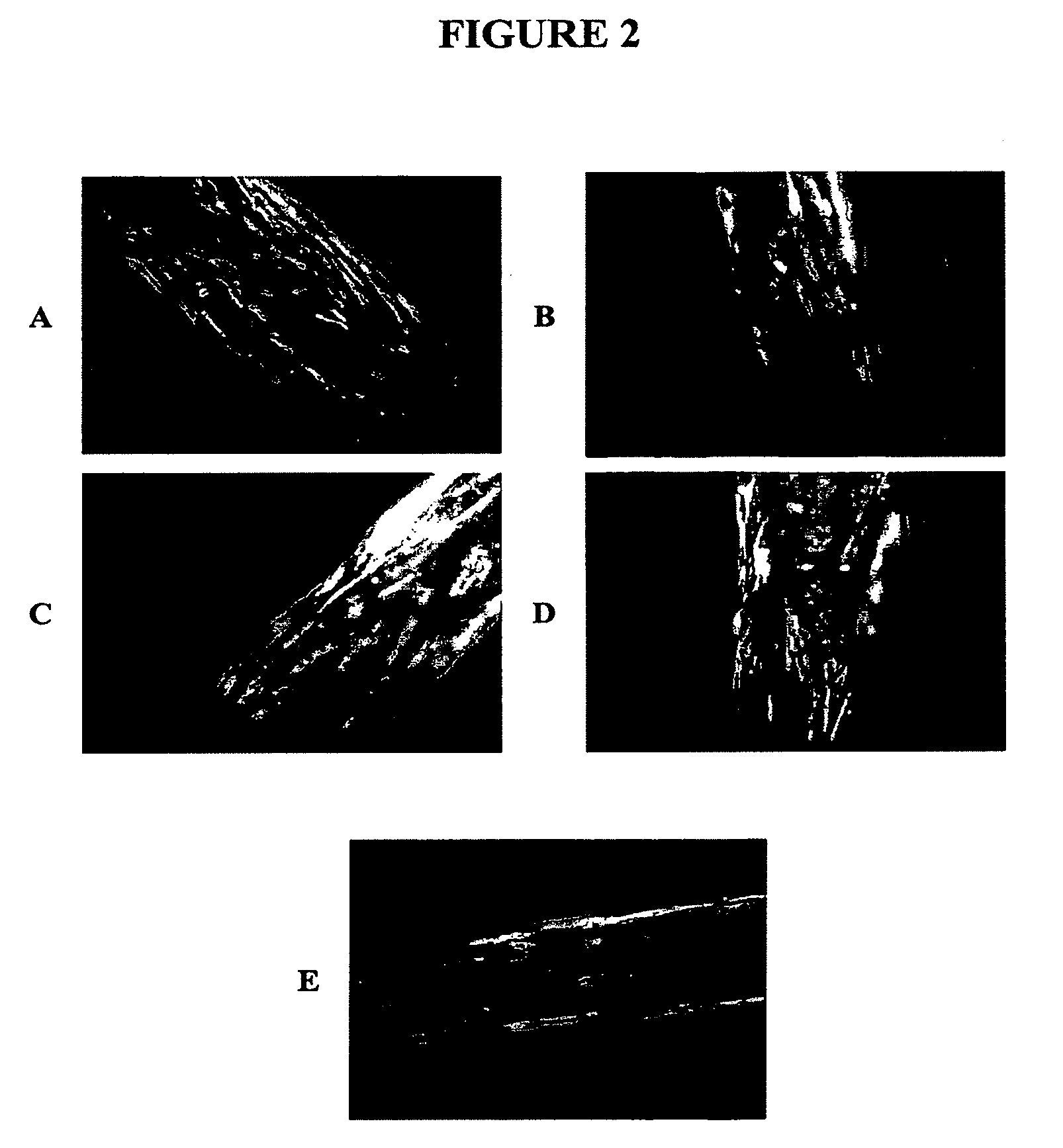 Biomaterial for Suturing