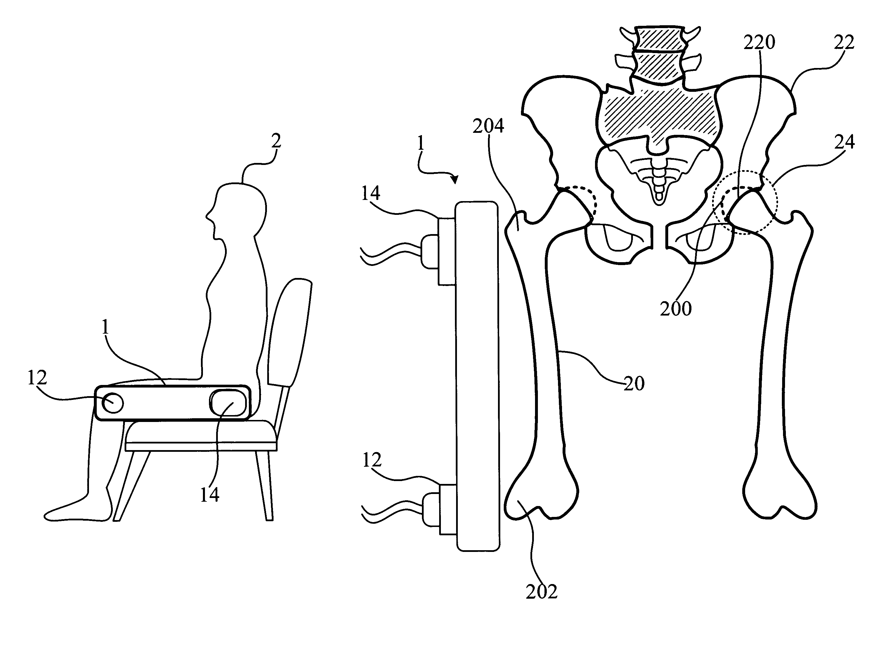 Bone examination apparatus and method