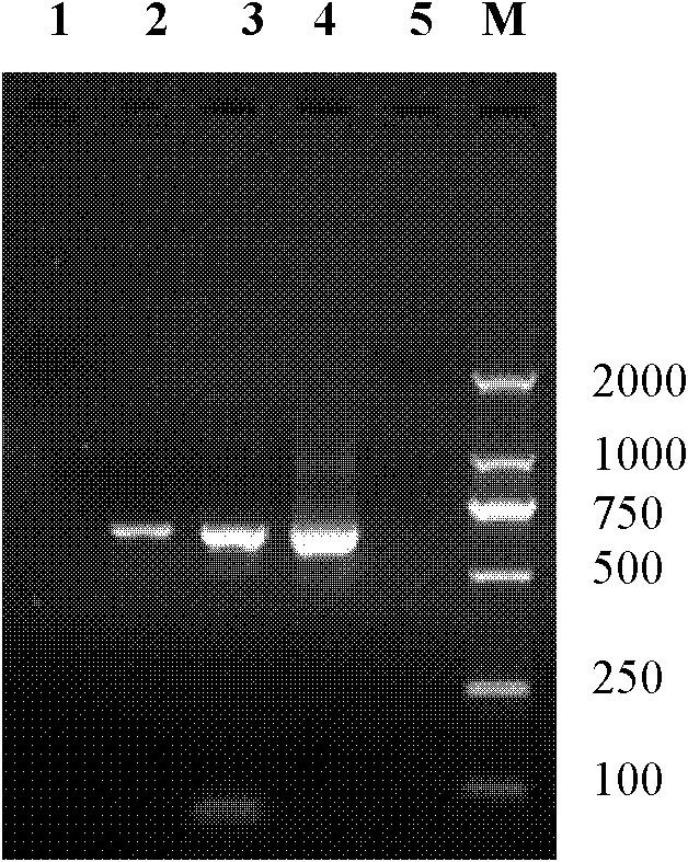 Recombinant standard plasmid for detecting anthrax bacillus, kit and construction method for the plasmid