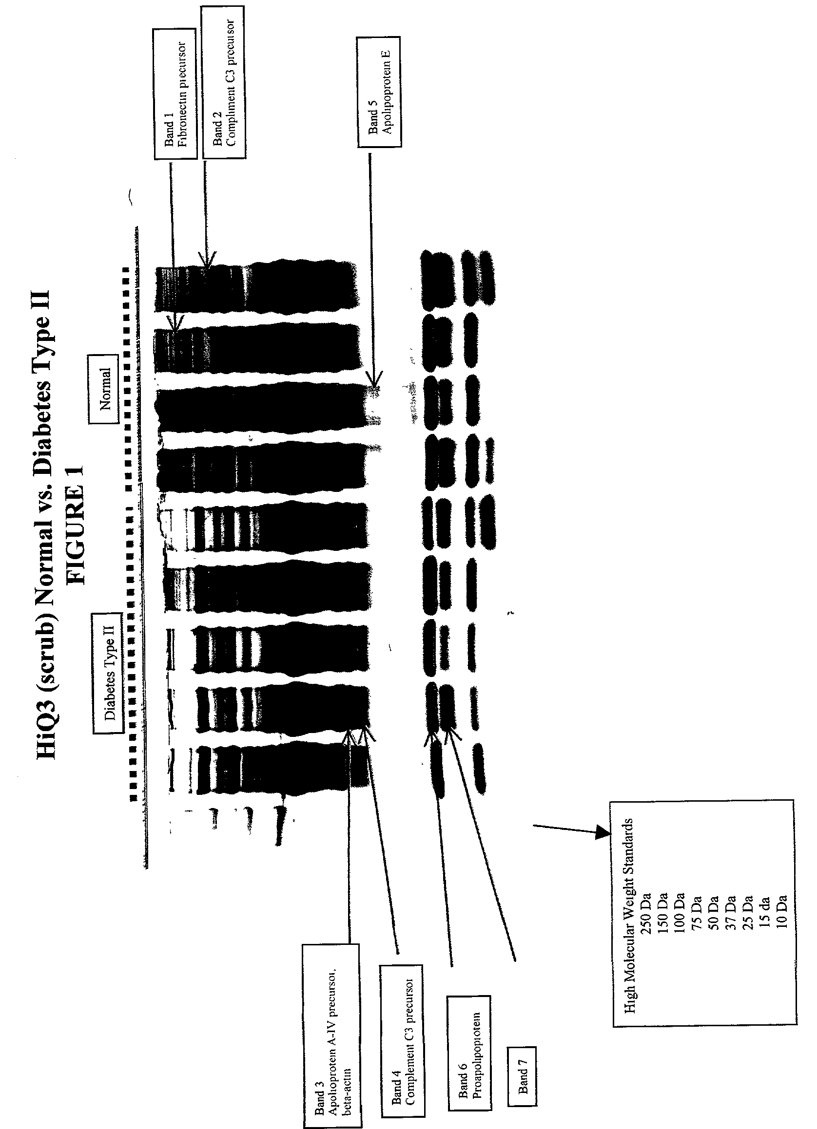 Protein biopolymer markers predictive of type ii diabetes