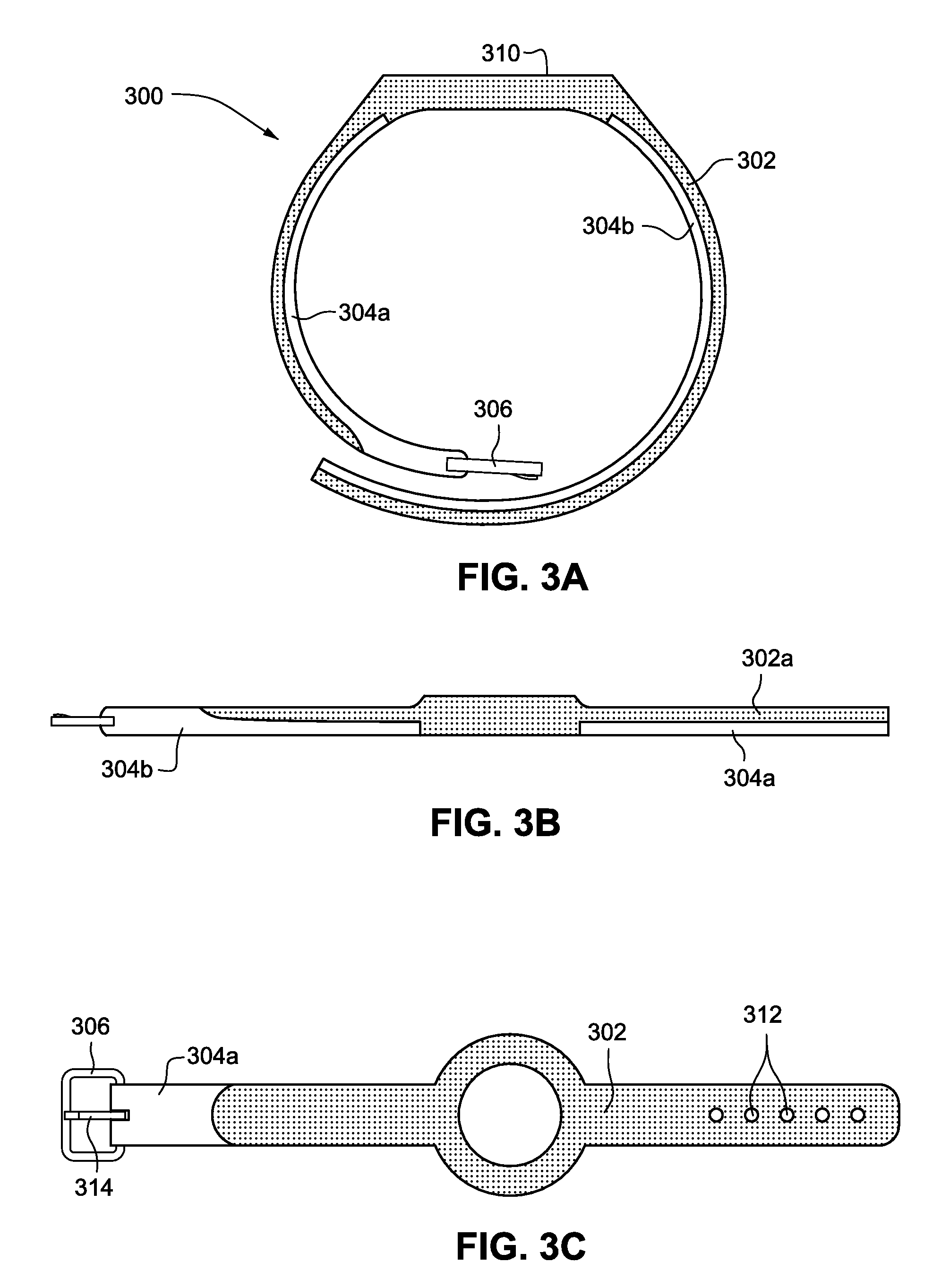 Tamper-alert resistant bands for human limbs and associated monitoring systems and methods