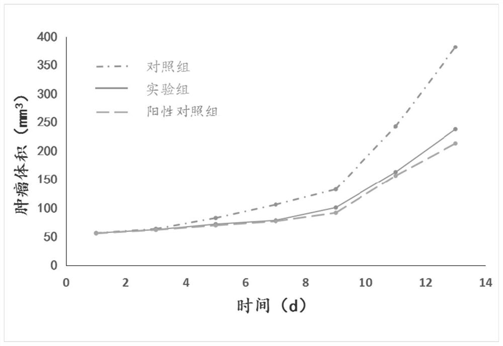 Composition for treating bladder cancer and preparation method thereof