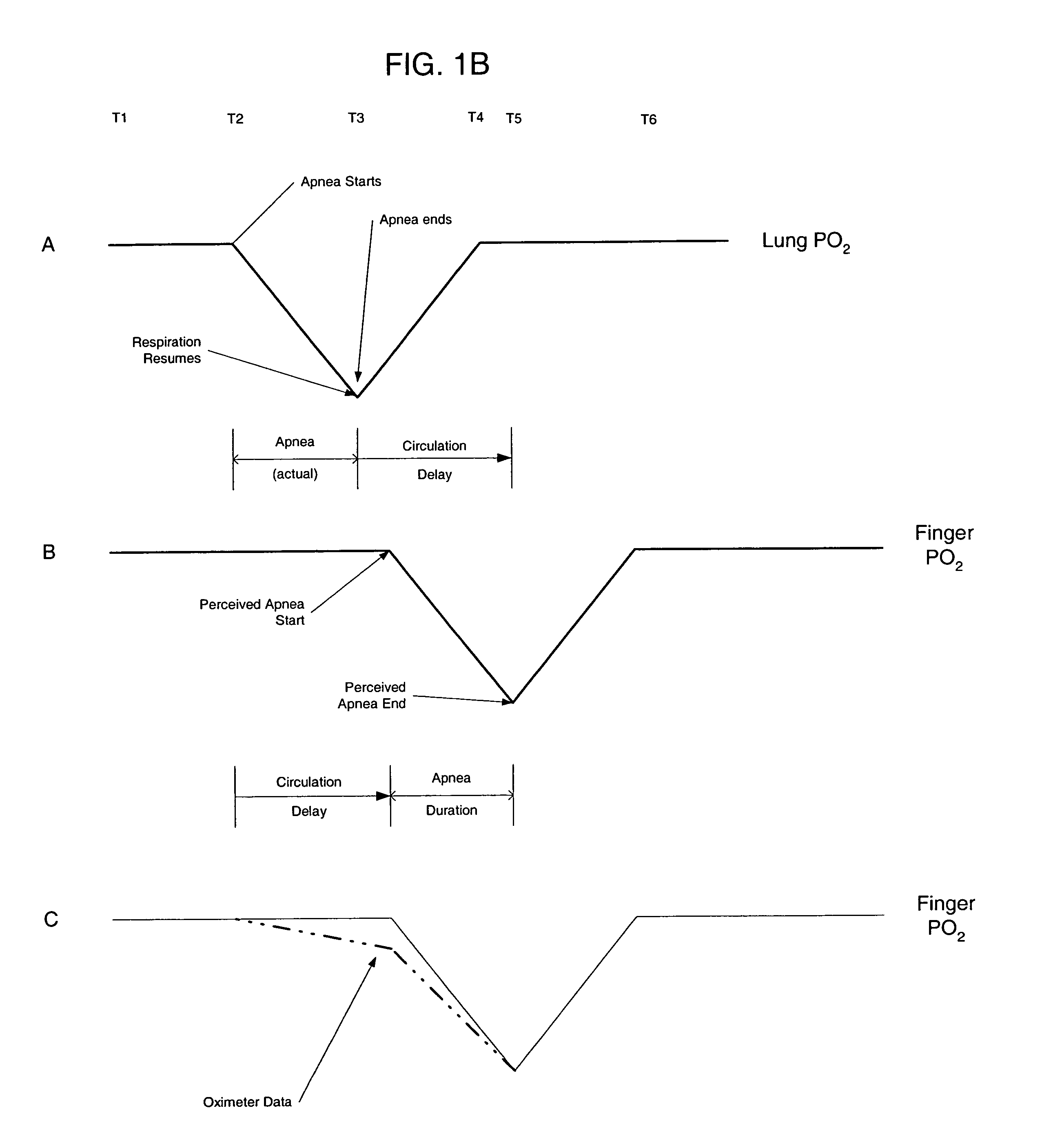 Implantable medical device with circulation delay measurement and therapy control