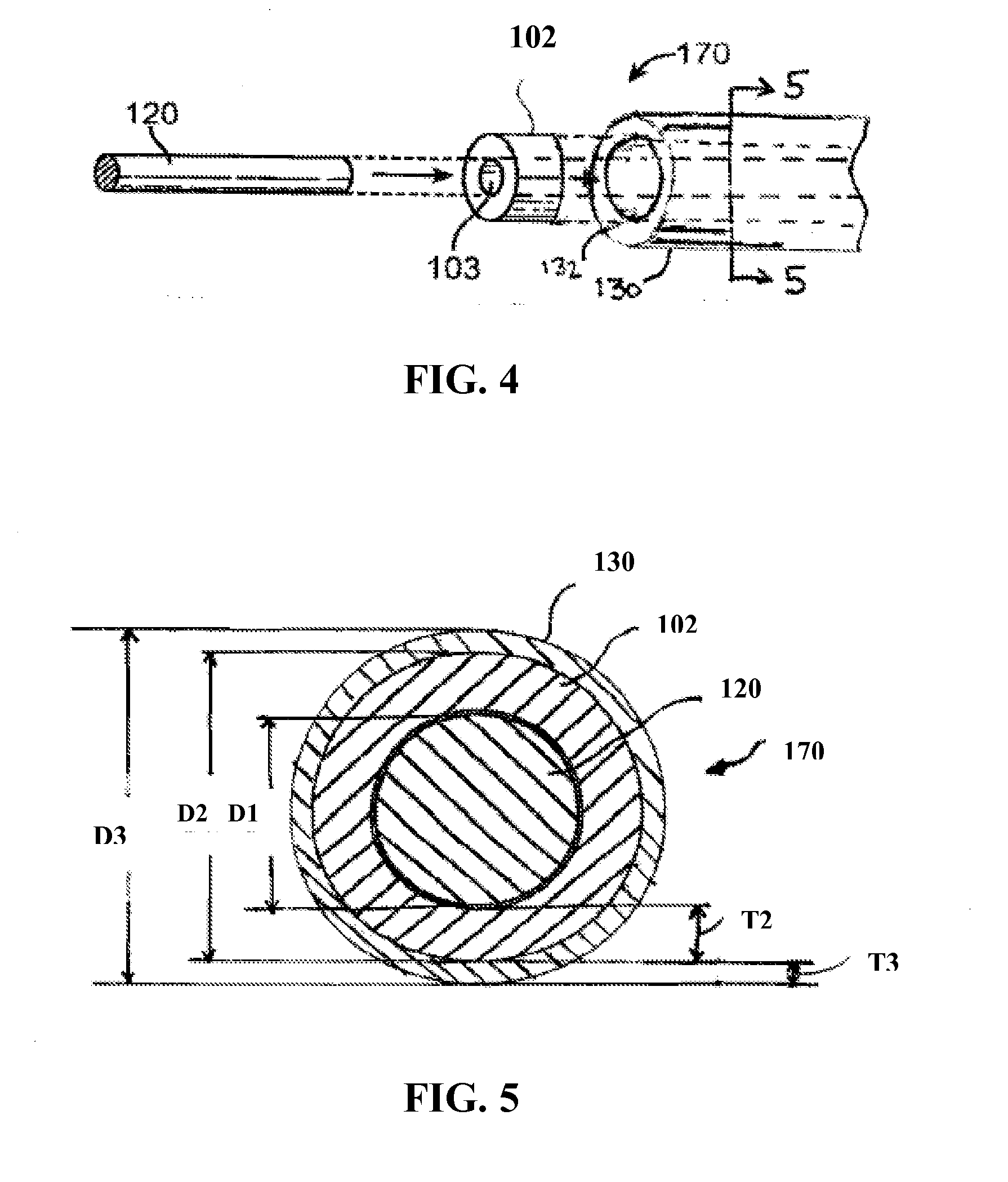 Method of forming a nitinol stent