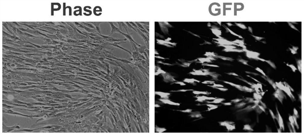 Human umbilical cord mesenchymal stem cell preparation and application thereof