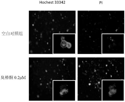 Detection method for evaluating intestine toxicity of medicine by utilizing 3D organ