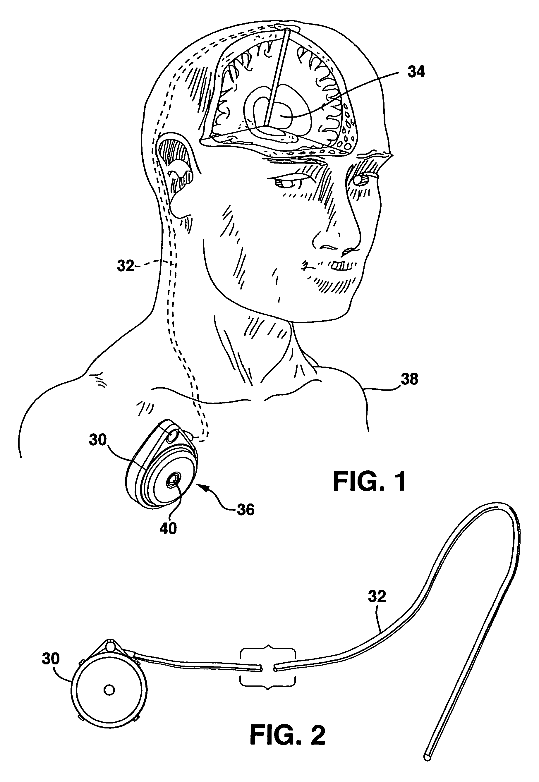 Low profile inlet valve for a piston pump therapeutic substance delivery device