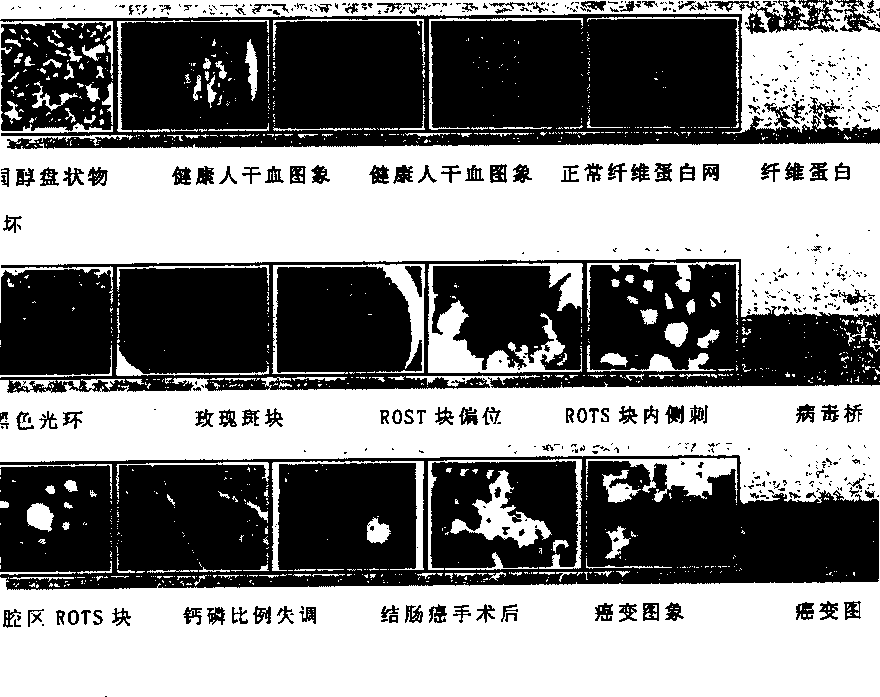 Early stage physical mutation forecasting system