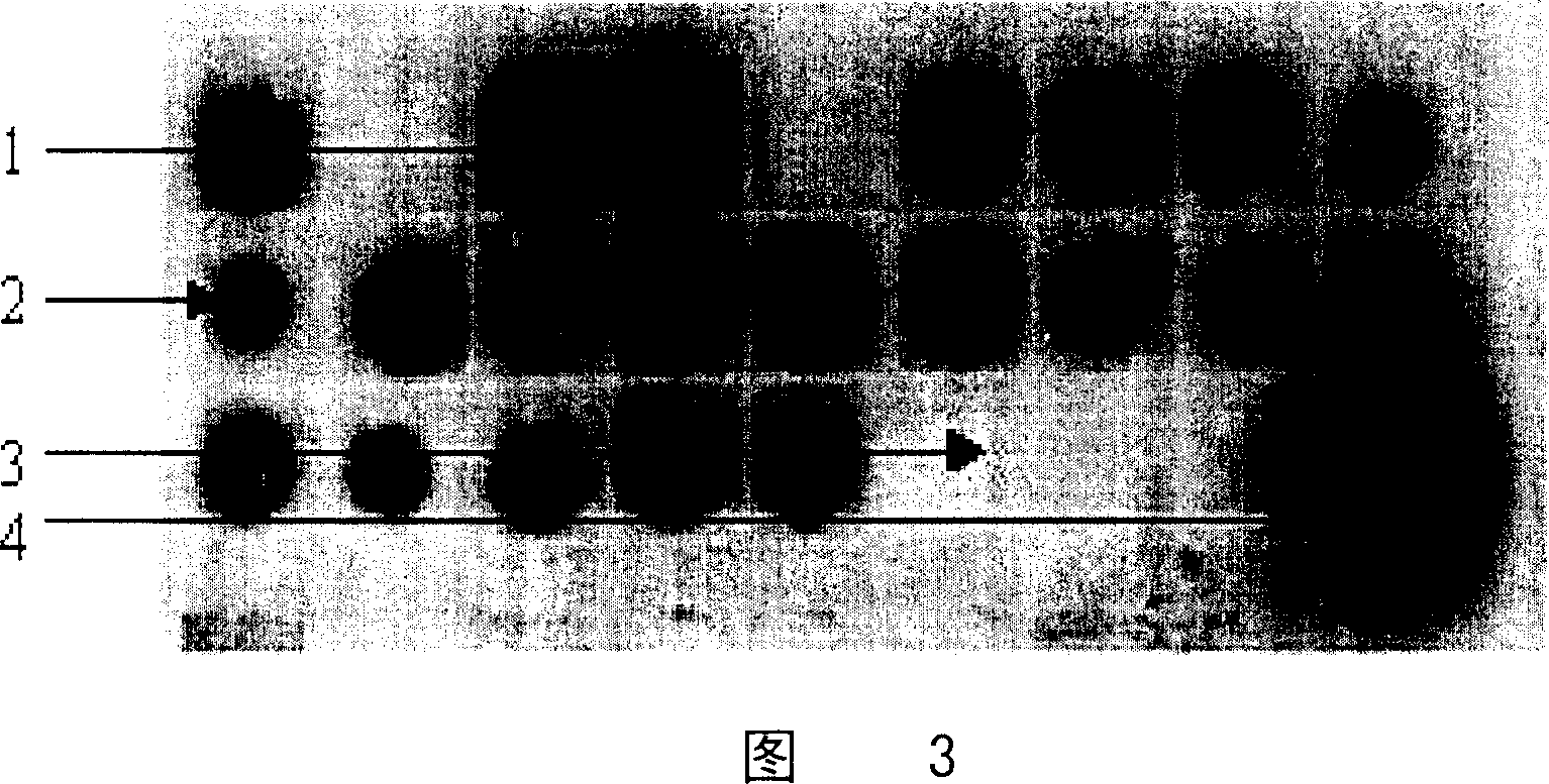 Preparation method of recombinant human plasminogen Kringle 5(hk5)