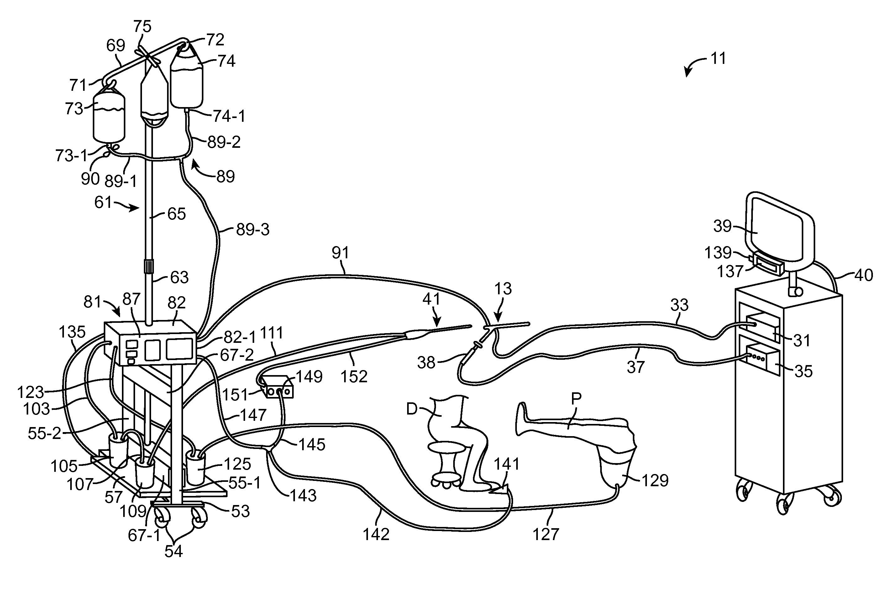 Hysteroscopic tissue removal system with improved fluid management and/or monitoring capabilities