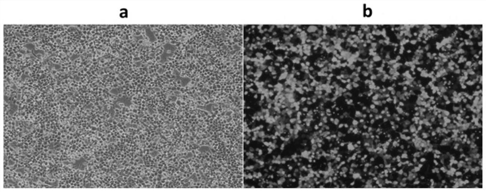 An enhanced anti-tumor NK cell and its preparation method and application