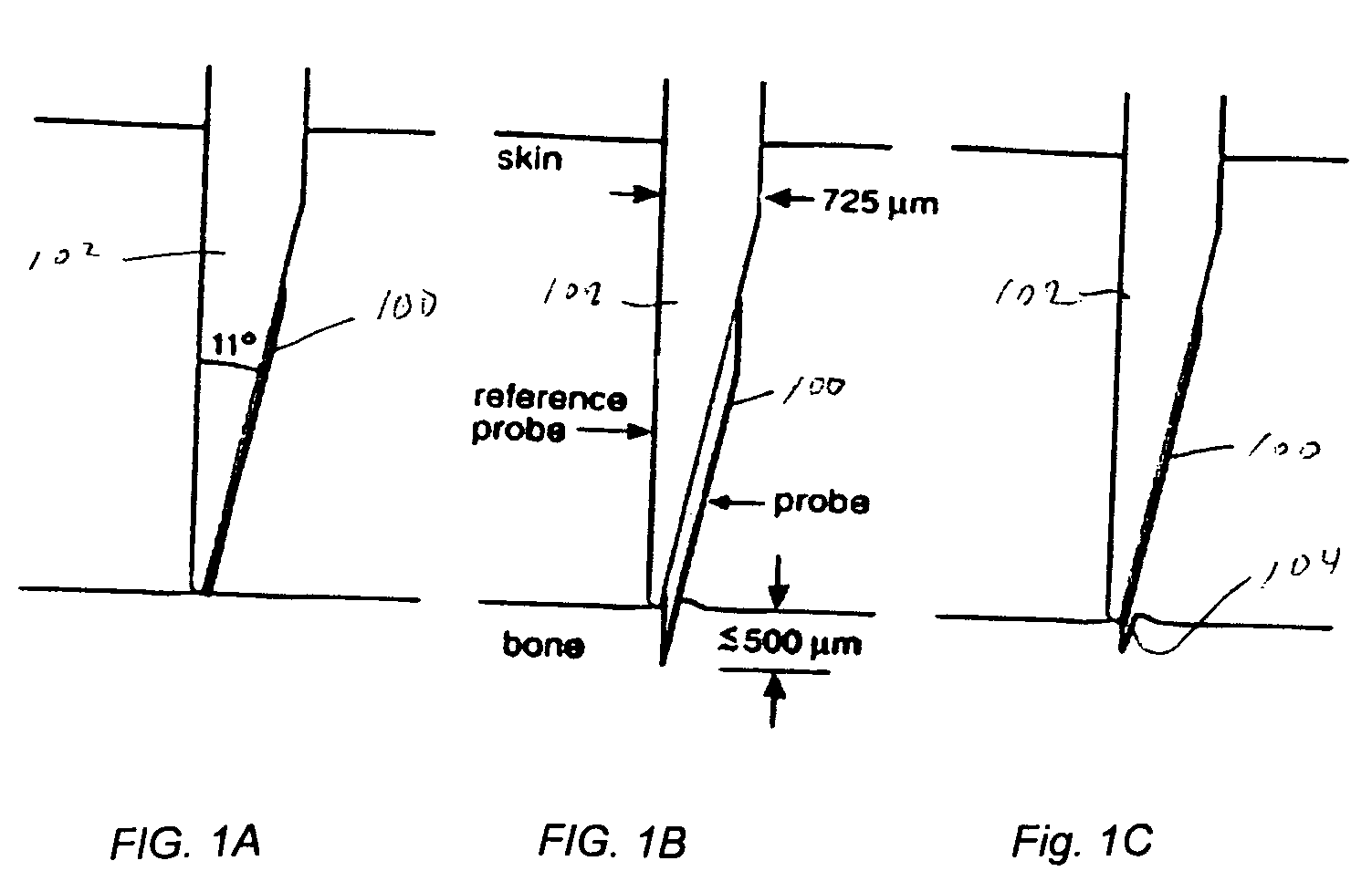 Methods and instruments for assessing bone fracture risk