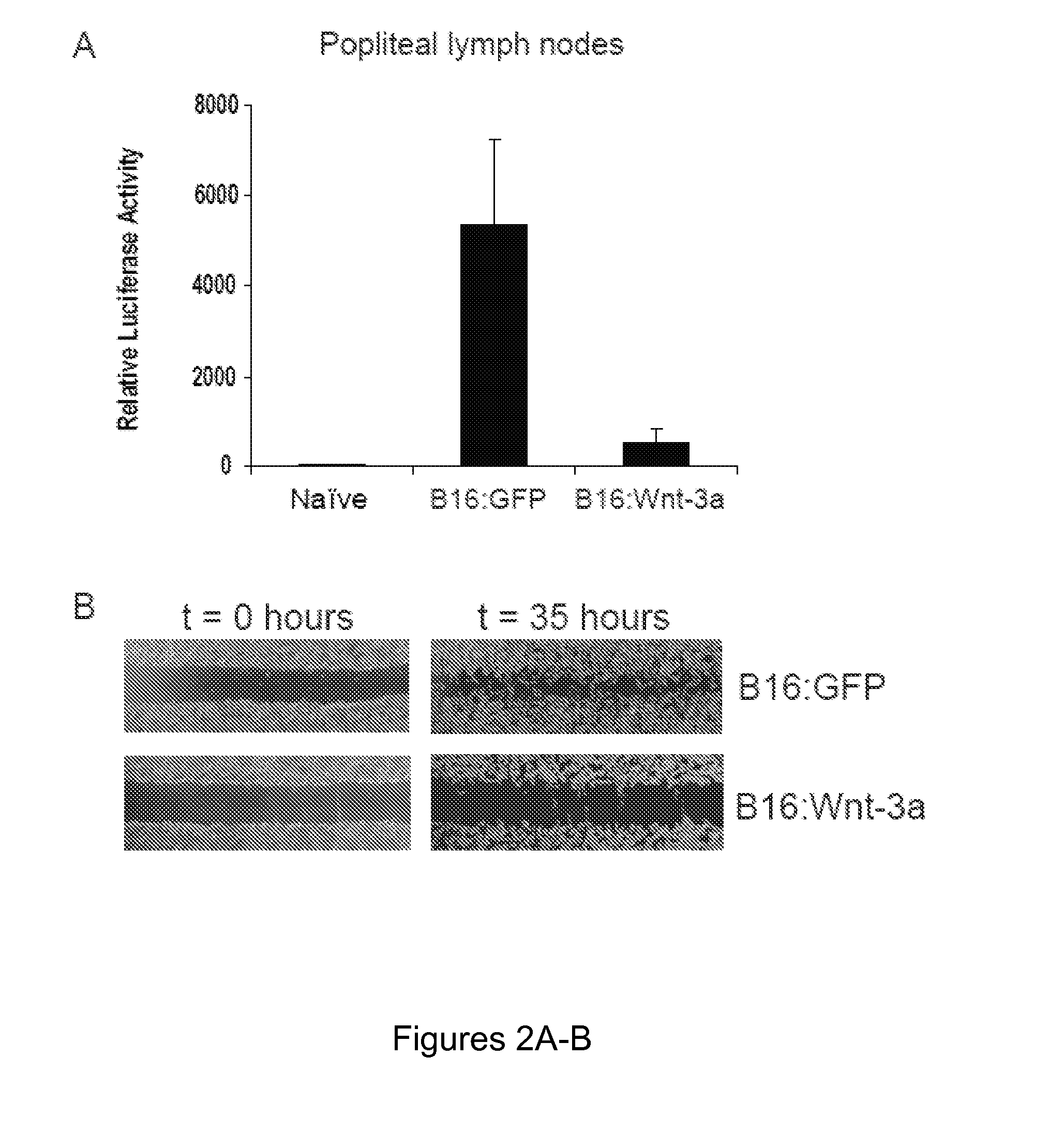 Compositions of modulators of the wnt/b-catenin pathway and an n-cinnamyl-n'benzhydryl piperazine and their use in treating neoplastic conditions including malignant melanoma