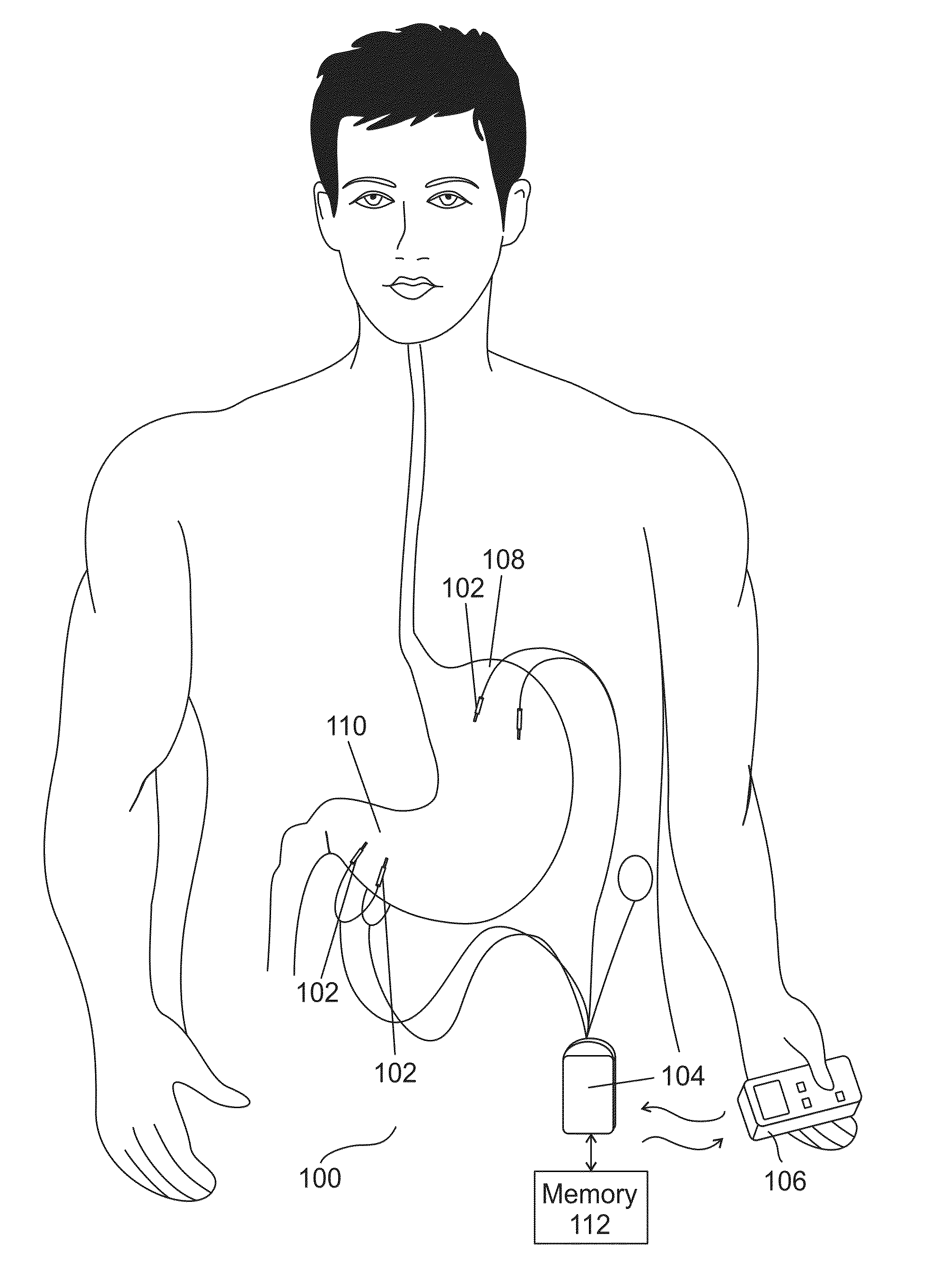 Method of treating a patient