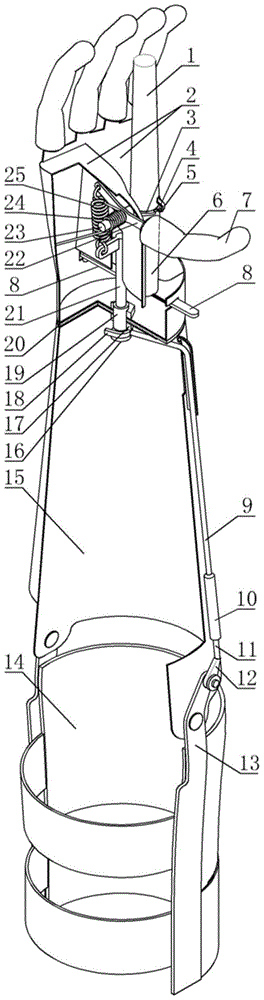 Upper Limb Prosthetics