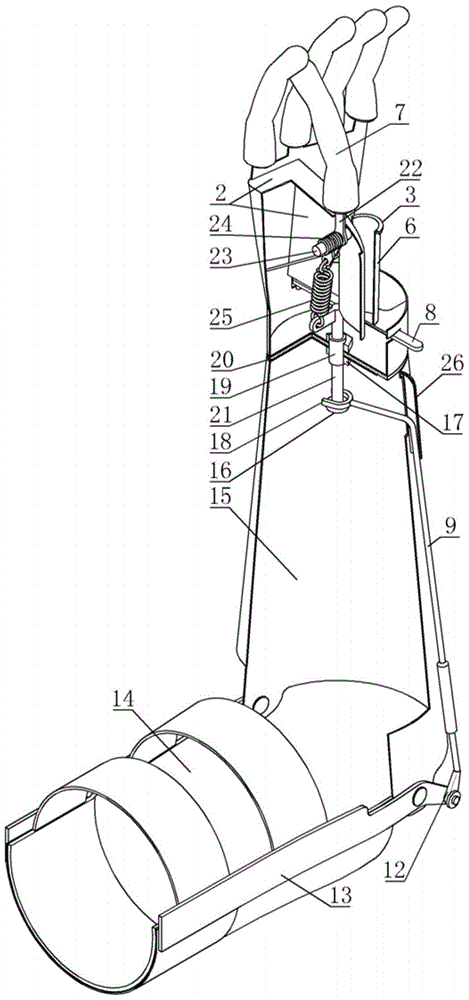 Upper Limb Prosthetics