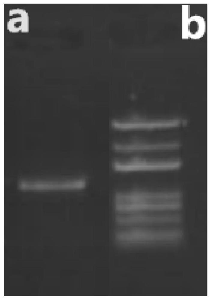 Serratia marcescens HL1 strain for treating Alzheimer's disease and application